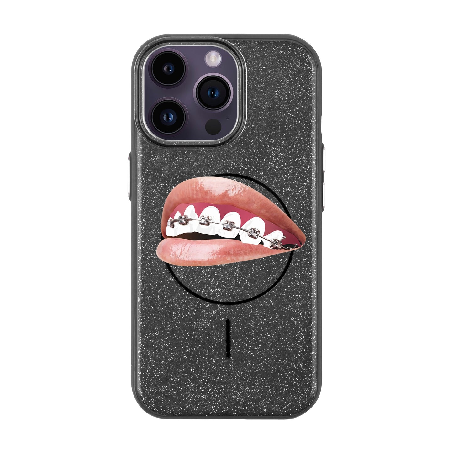 ORTHODONTIST-iPhone 14 Pro Max Radiant Kılıf MagSafe Özellikli