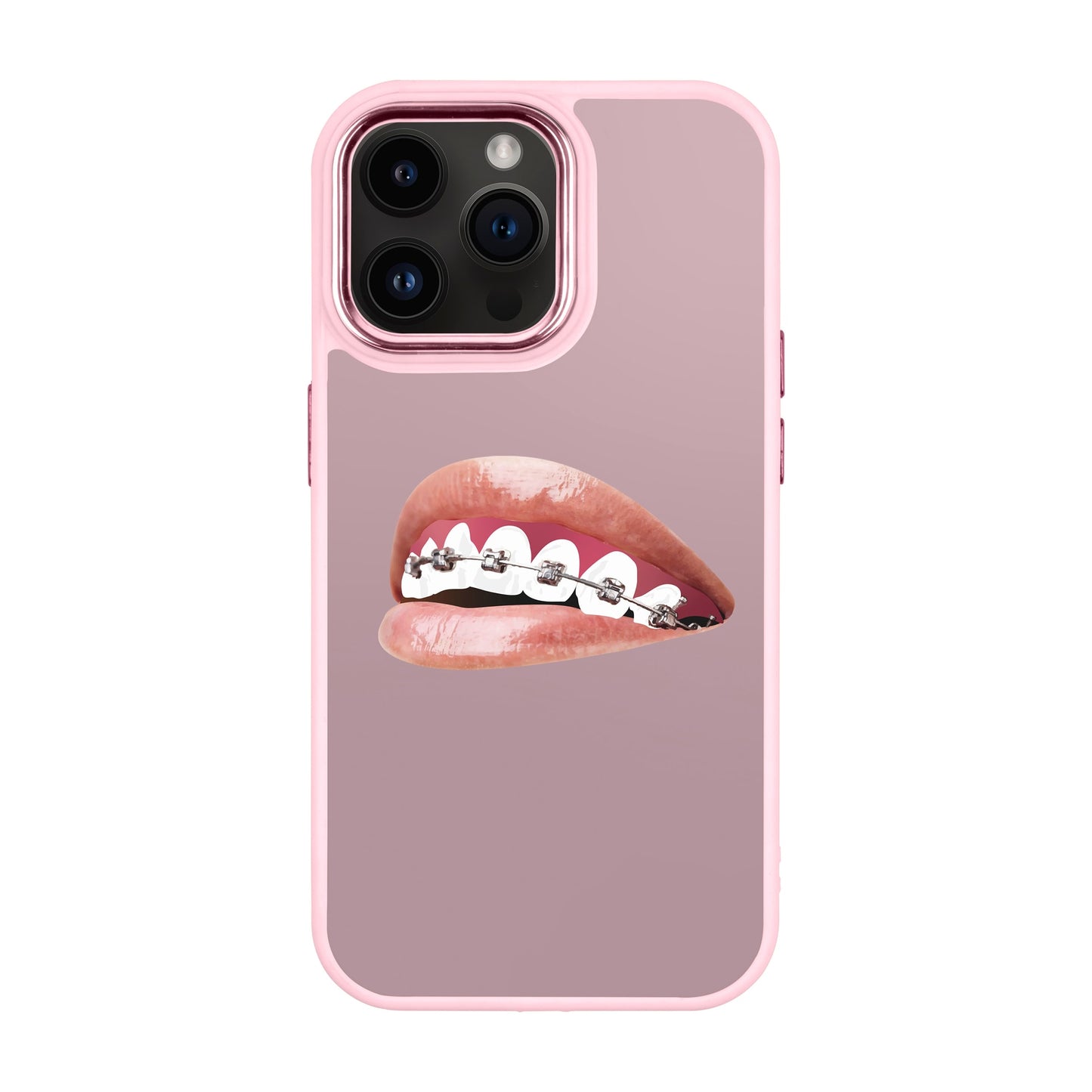 ORTHODONTIST-iPhone 14 Pro Max Proof Kılıf