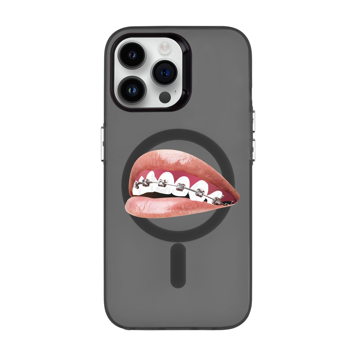 ORTHODONTIST-iPhone 14 Pro Max Hold Kılıf MagSafe Özellikli