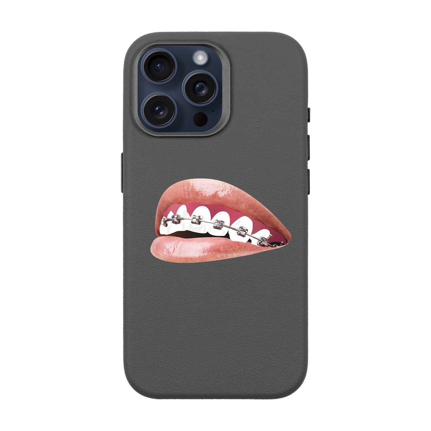 ORTHODONTIST-iPhone 15 Pro Max Leather Premium Kılıf MagSafe Özellikli