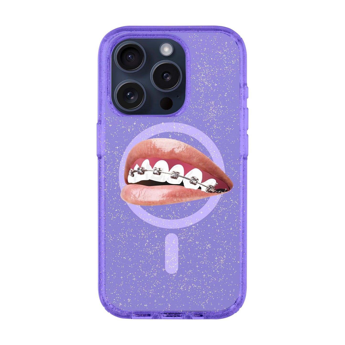 ORTHODONTIST-iPhone 15 Pro Shiny Kılıf MagSafe Özellikli