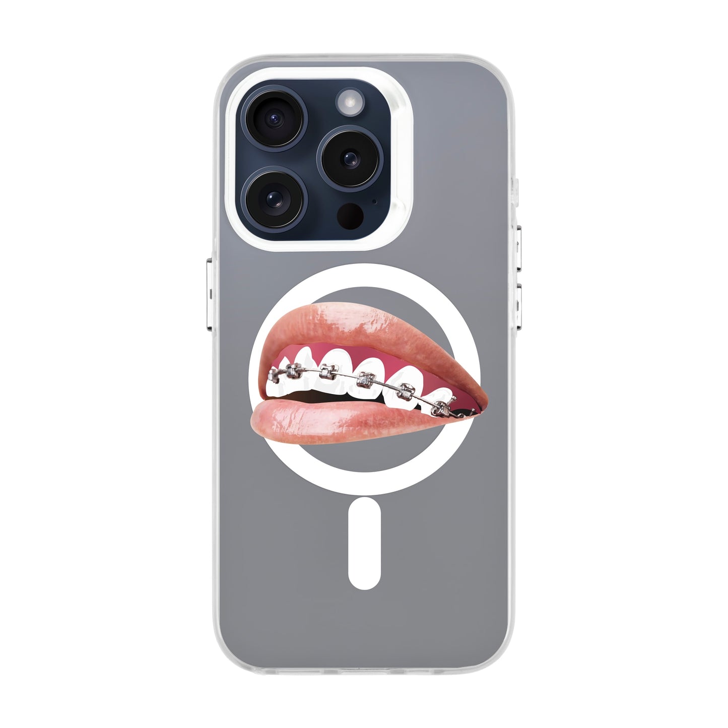 ORTHODONTIST-iPhone 15 Pro Hold Kılıf MagSafe Özellikli