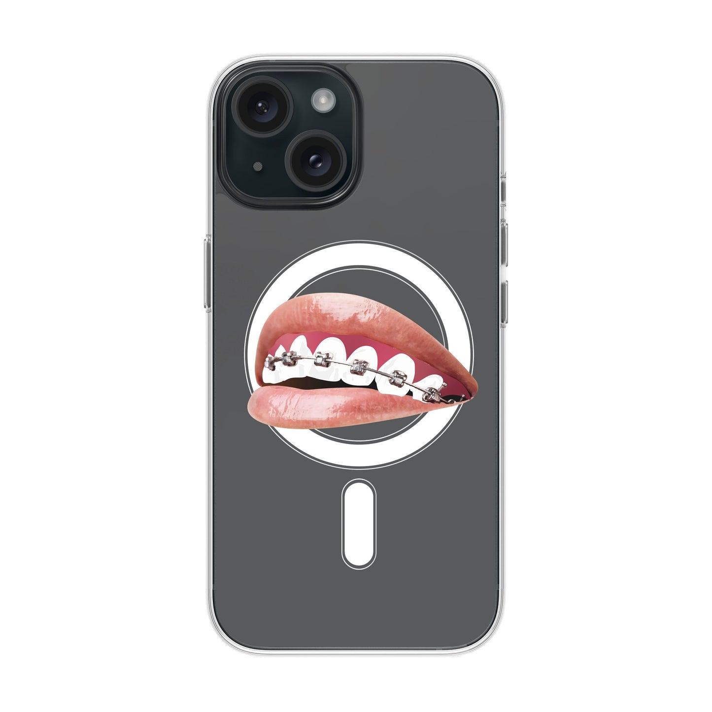 ORTHODONTIST-iPhone 15 Solid Kılıf MagSafe Özellikli