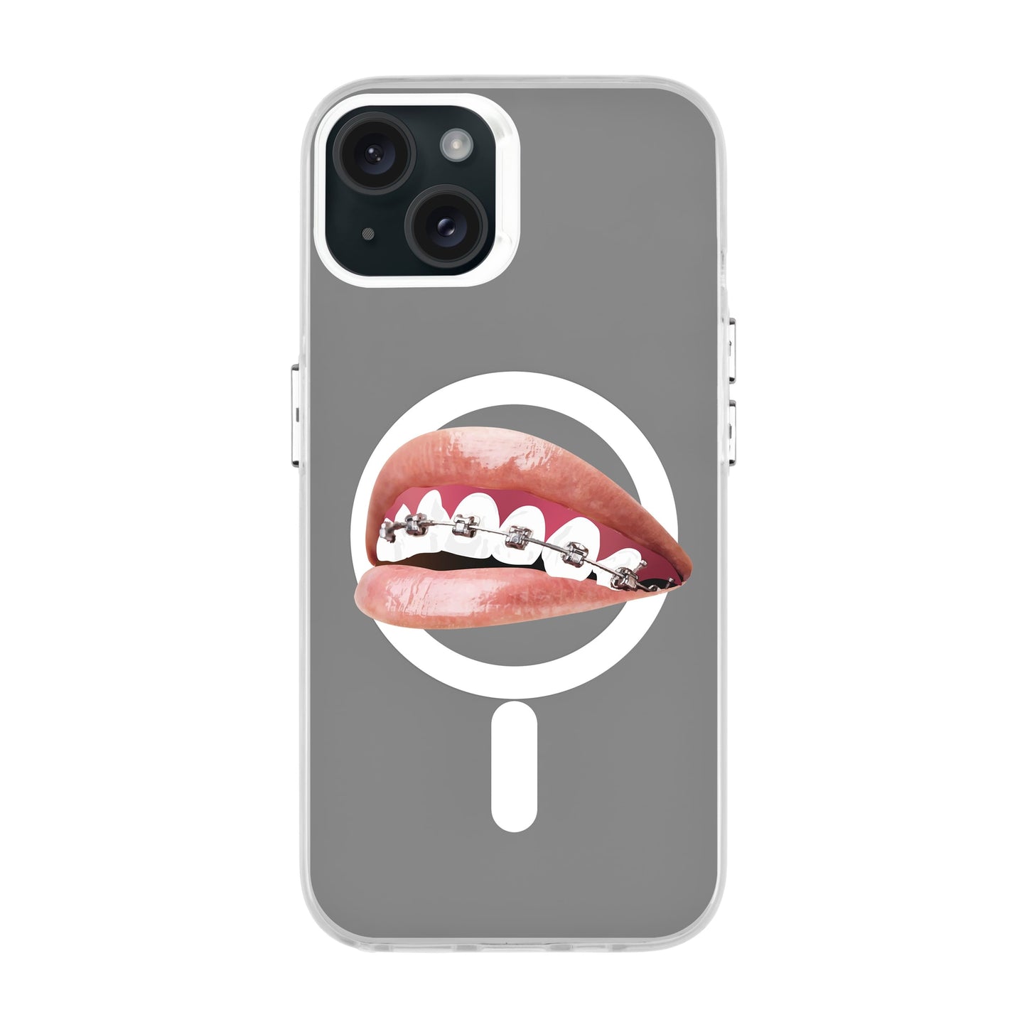 ORTHODONTIST-iPhone 15 Plus Hold Kılıf MagSafe Özellikli