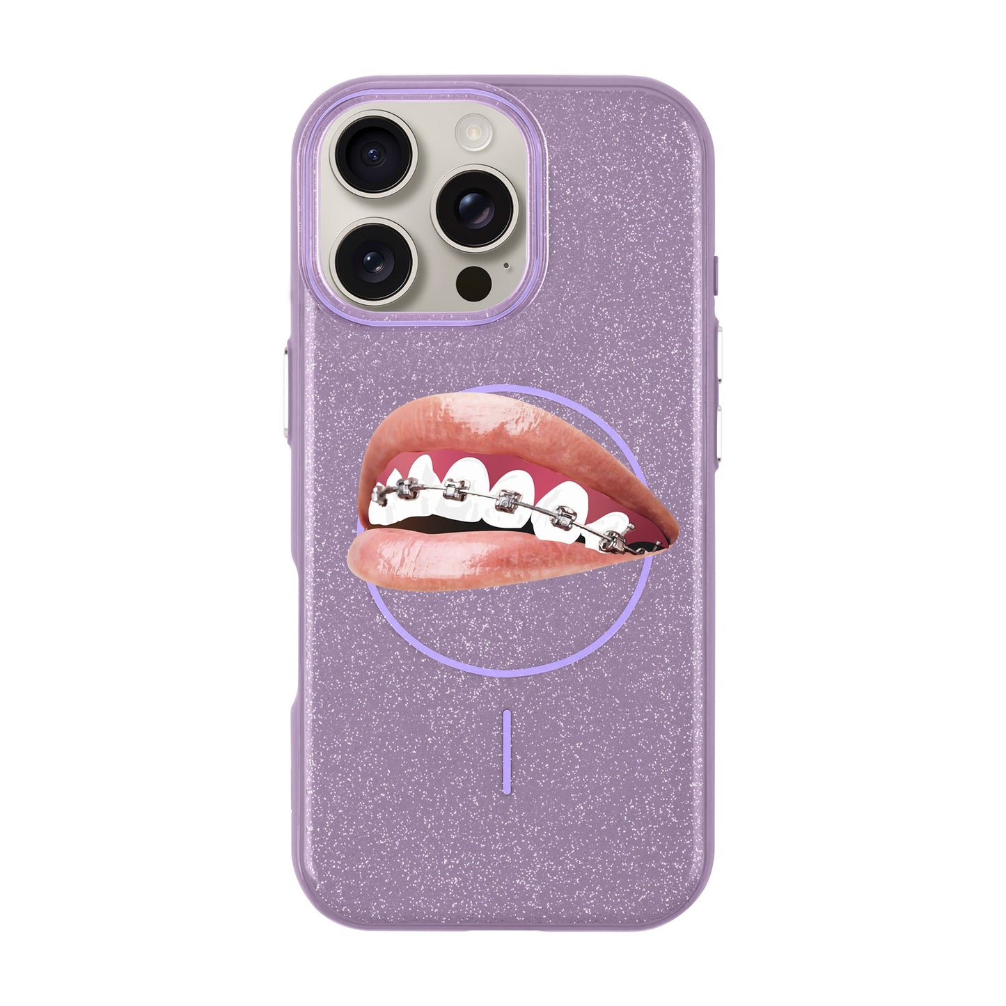 ORTHODONTIST-iPhone 16 Pro Max Radiant Kılıf MagSafe Özellikli
