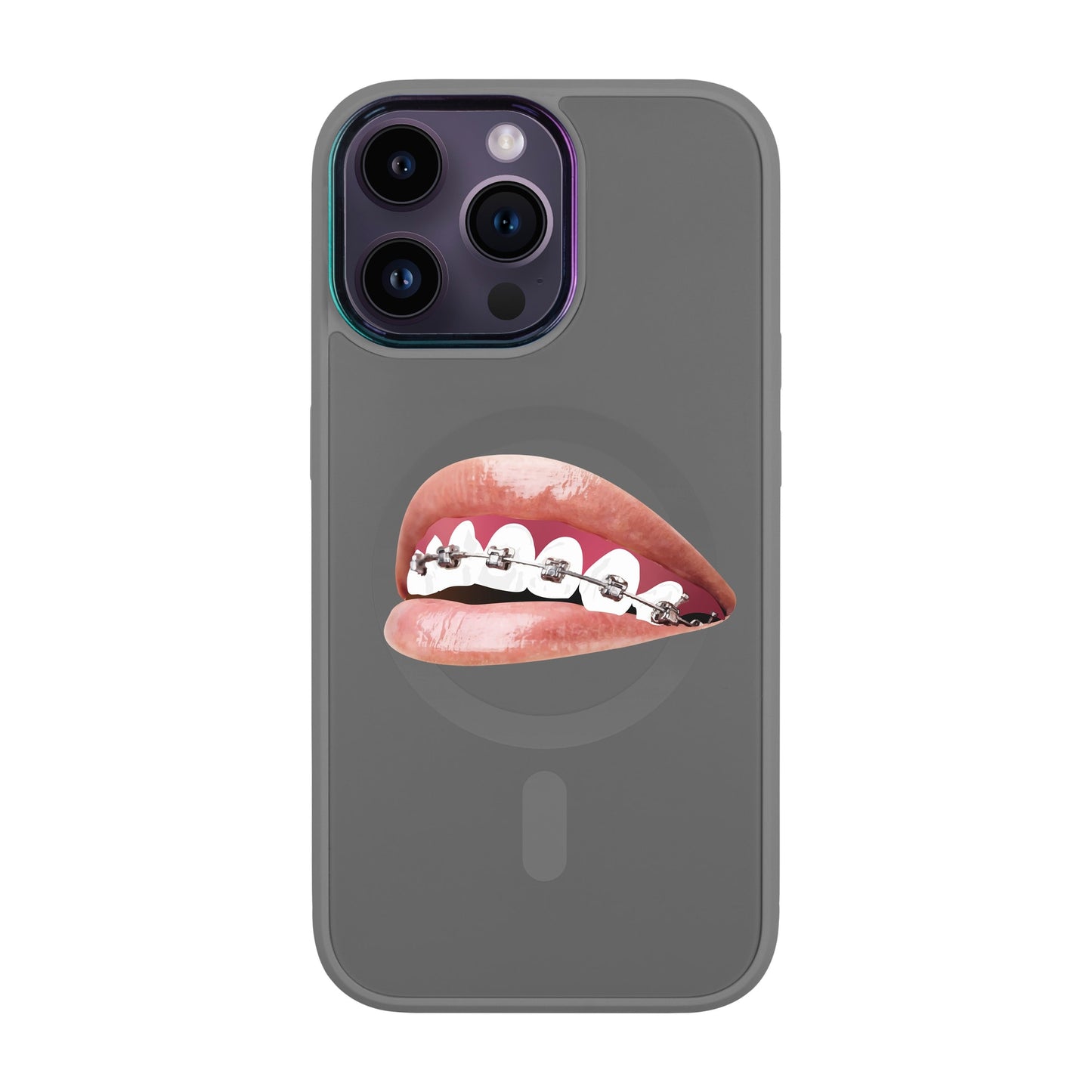 ORTHODONTİST-iPhone 14 Pro Max Vigor Kılıf MagSafe Özellikli