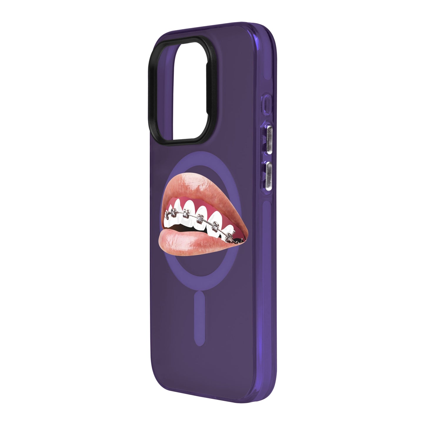 ORTHODONTIST-iPhone 15 Pro Hold Kılıf MagSafe Özellikli