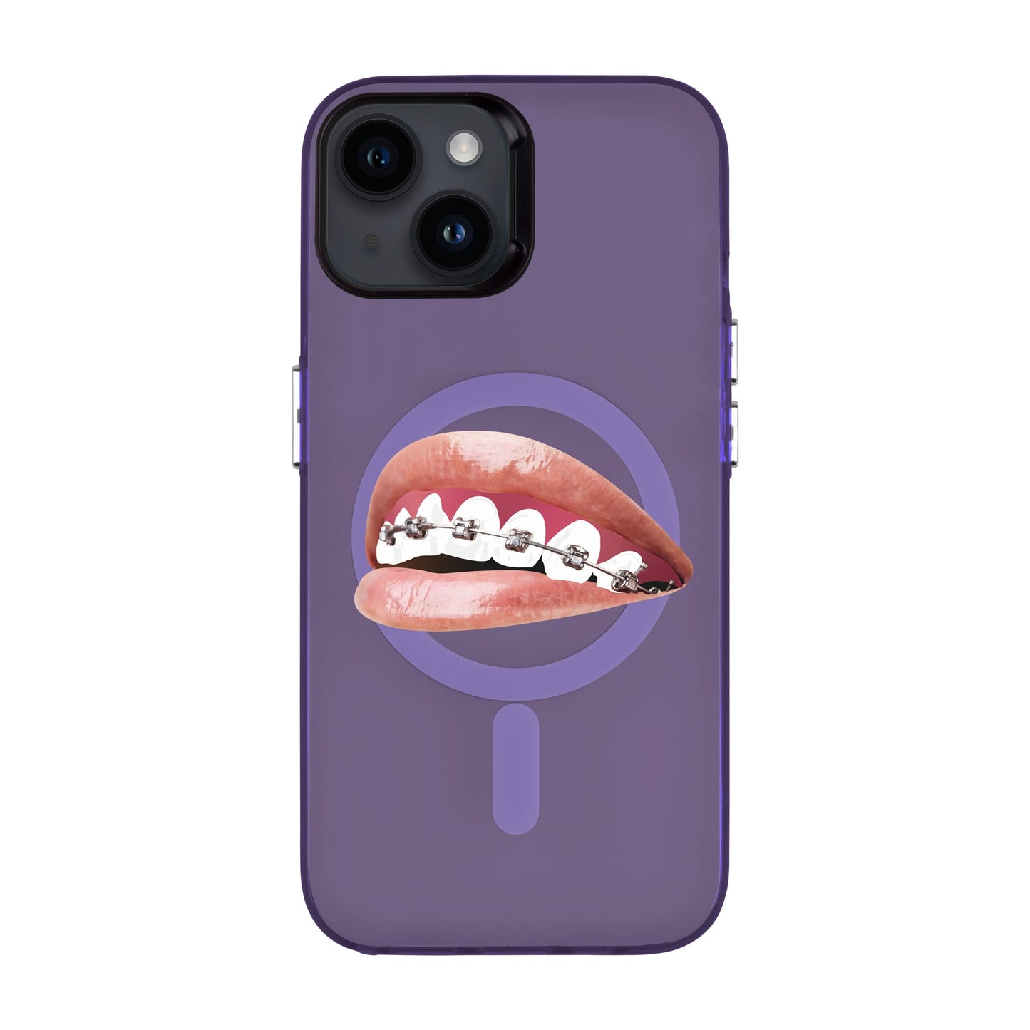 ORTHODONTIST-iPhone 14 Hold Kılıf MagSafe Özellikli