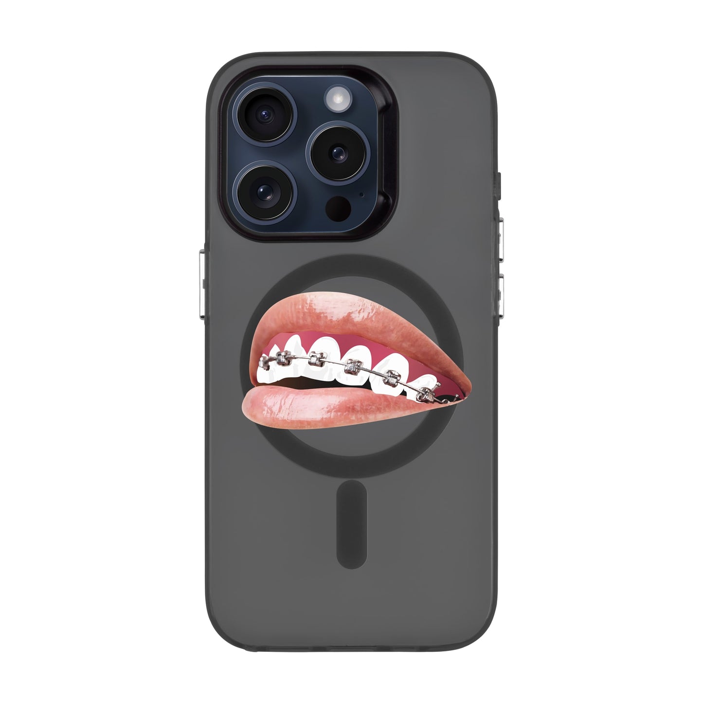 ORTHODONTIST-iPhone 15 Pro Hold Kılıf MagSafe Özellikli