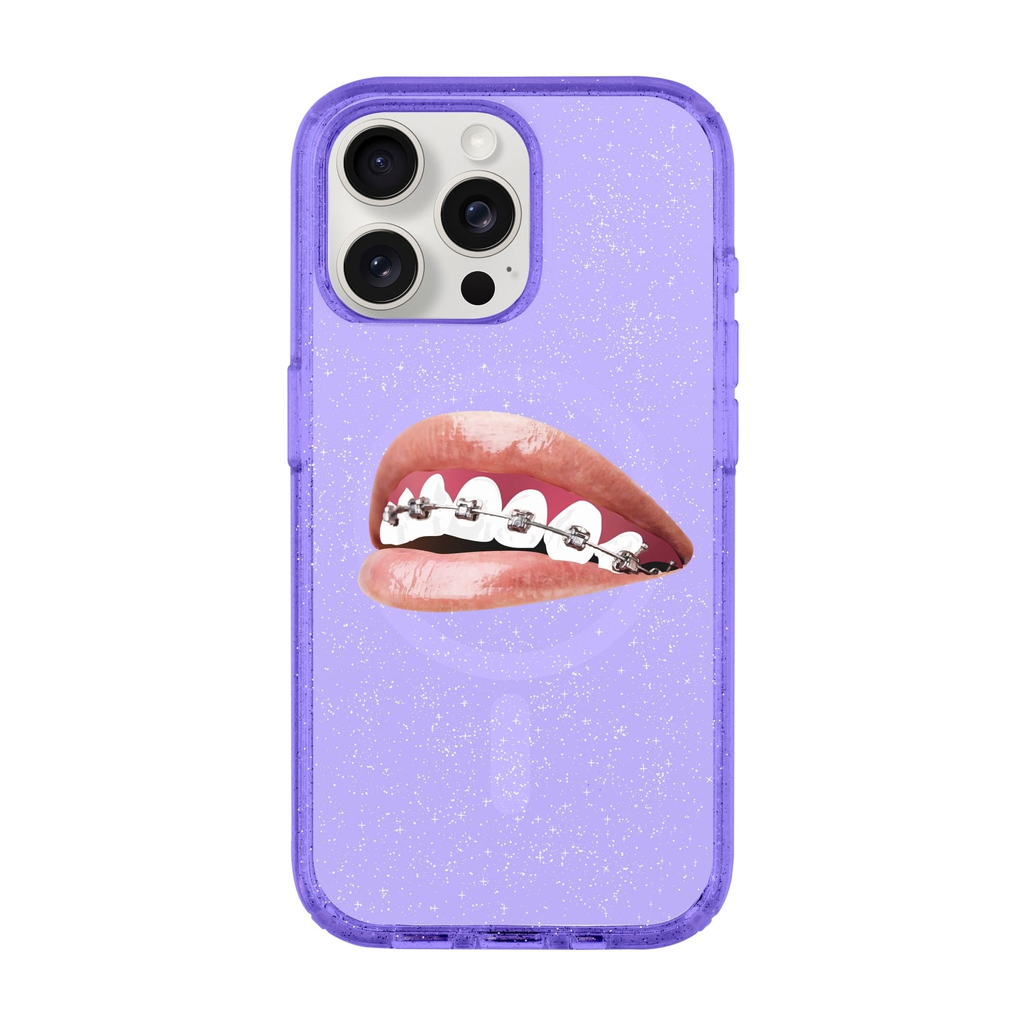 ORTHODONTIST-iPhone 15 Pro Max Shiny Kılıf MagSafe Özellikli