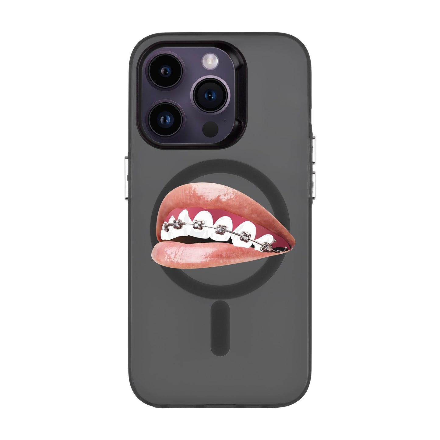 ORTHODONTIST-iPhone 14 Pro Hold Kılıf MagSafe Özellikli