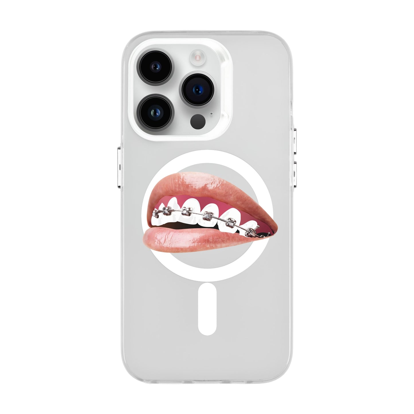 ORTHODONTIST-iPhone 14 Pro Hold Kılıf MagSafe Özellikli