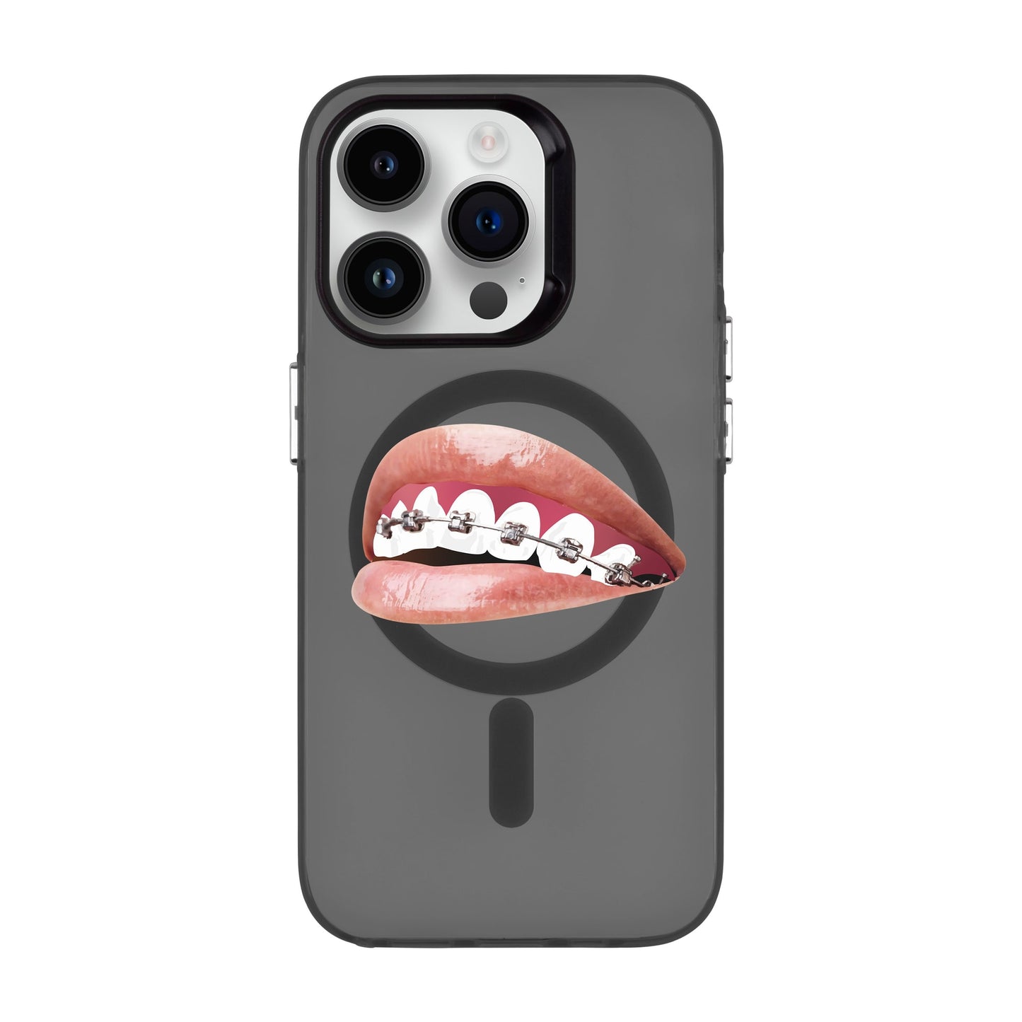 ORTHODONTIST-iPhone 14 Pro Hold Kılıf MagSafe Özellikli