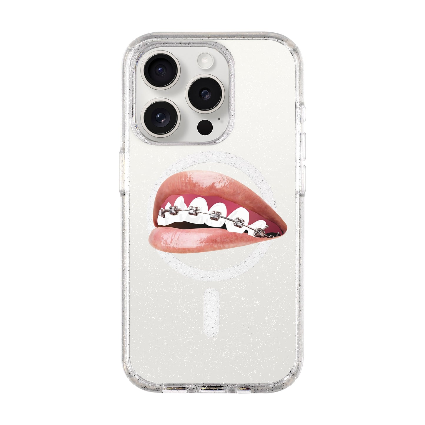 ORTHODONTIST-iPhone 15 Pro Shiny Kılıf MagSafe Özellikli
