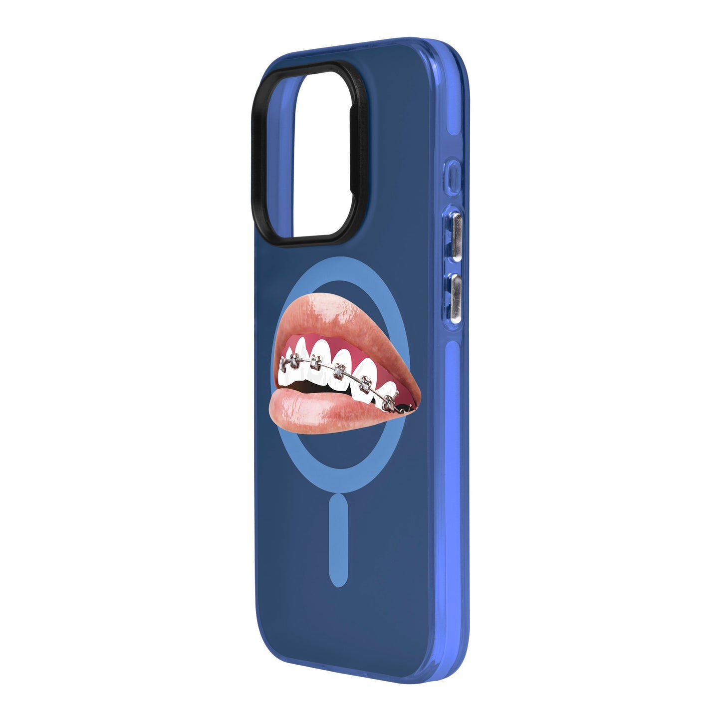 ORTHODONTIST-iPhone 15 Pro Hold Kılıf MagSafe Özellikli