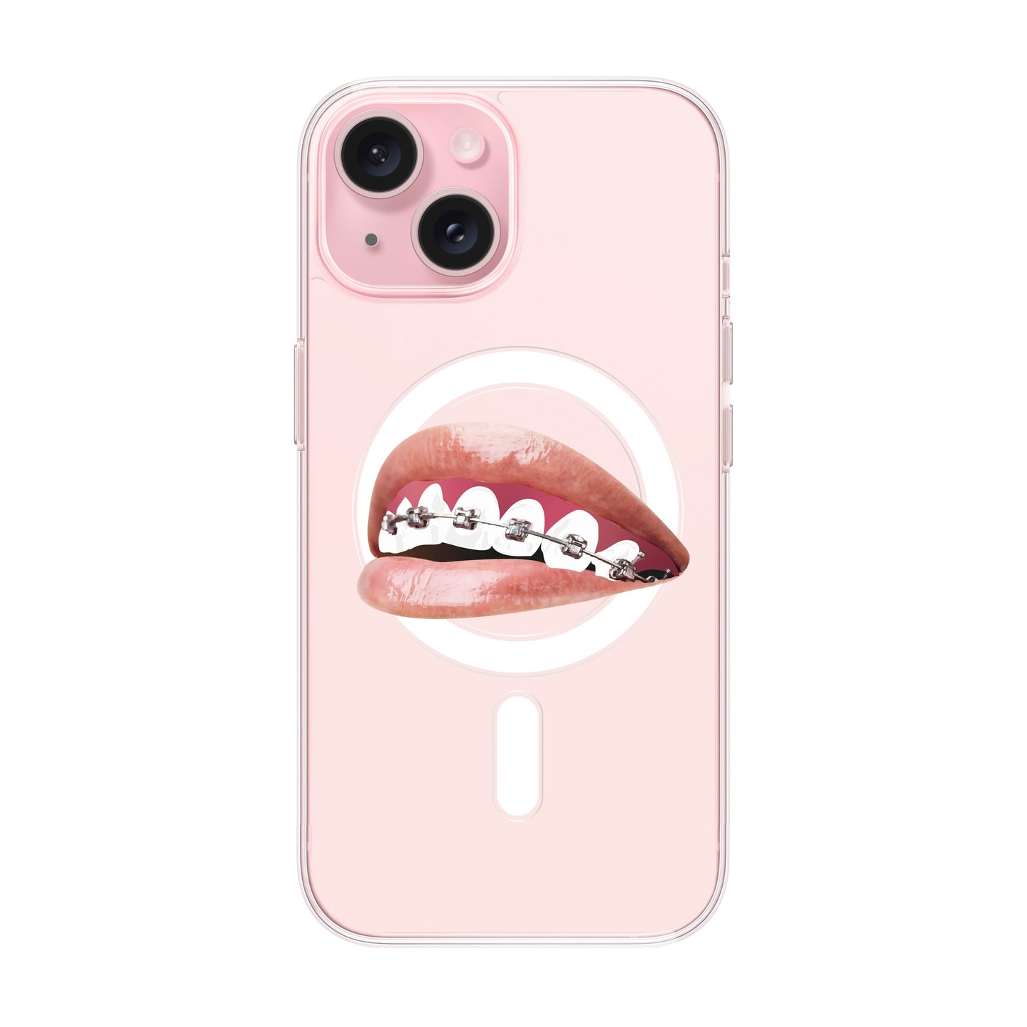 ORTHODONTIST-iPhone 15 Solid Kılıf MagSafe Özellikli