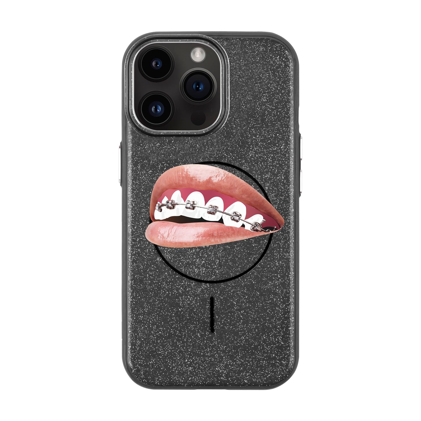 ORTHODONTIST-iPhone 14 Pro Max Radiant Kılıf MagSafe Özellikli