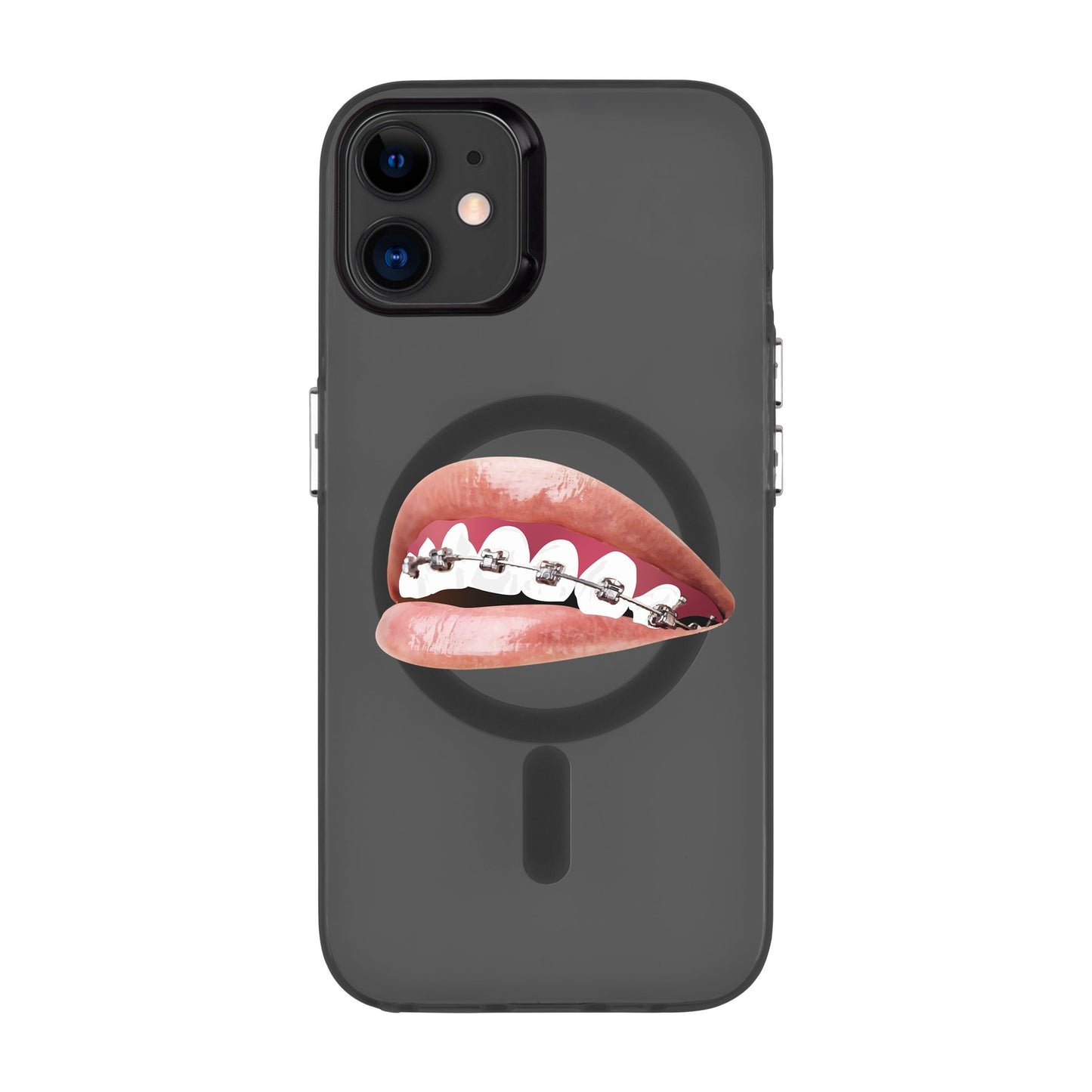 ORTHODONTIST-iPhone 11 Hold Kılıf MagSafe Özellikli