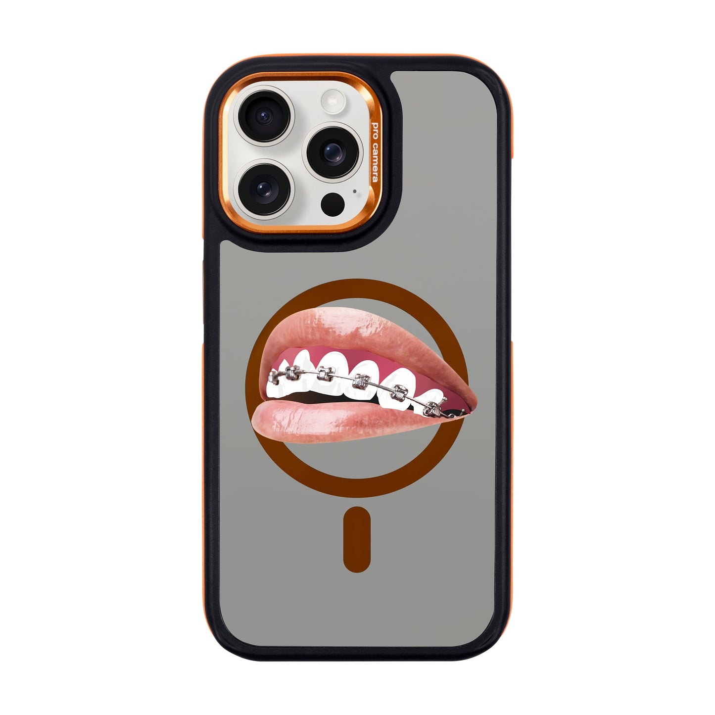 ORTHODONTIST-iPhone 15 Pro Max Dark Kılıf MagSafe Özellikli