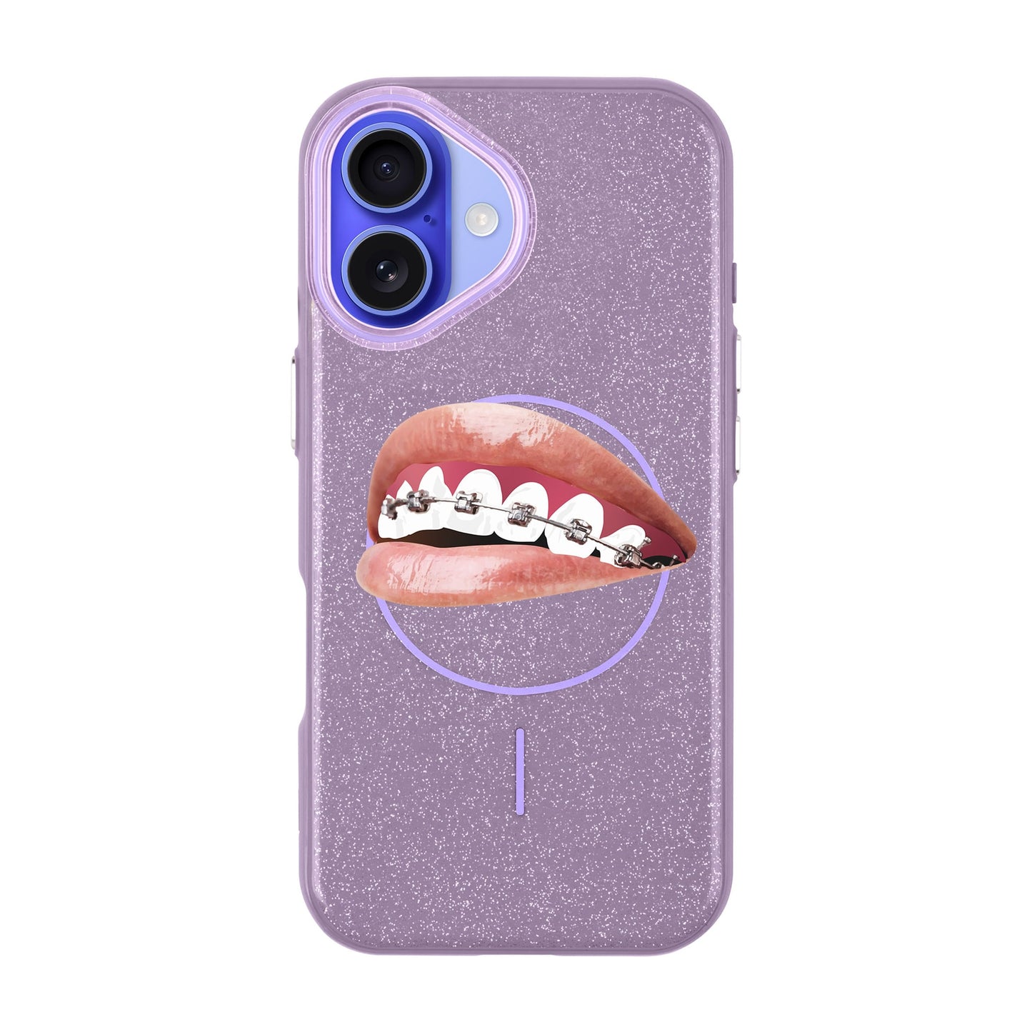ORTHODONTIST-iPhone 16 Plus Radiant Kılıf MagSafe Özellikli