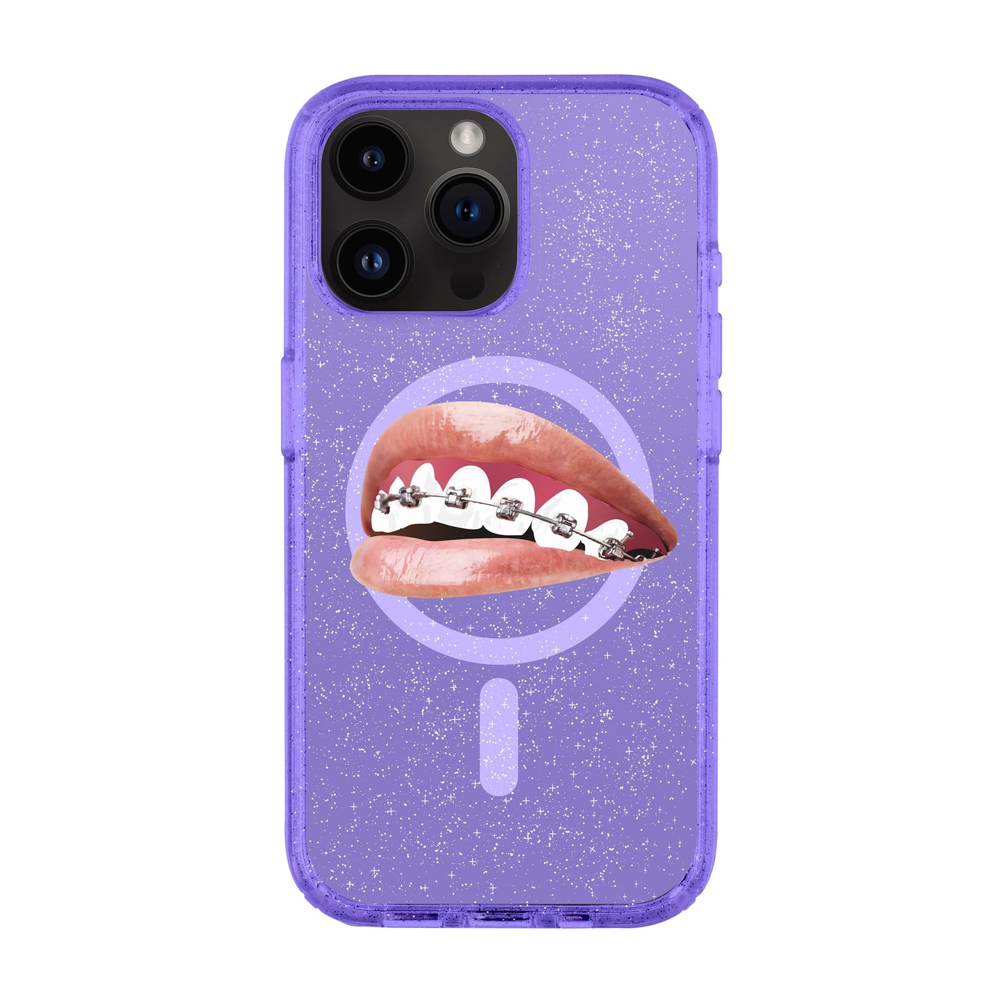 ORTHODONTIST-iPhone 14 Pro Max Shiny Kılıf MagSafe Özellikli