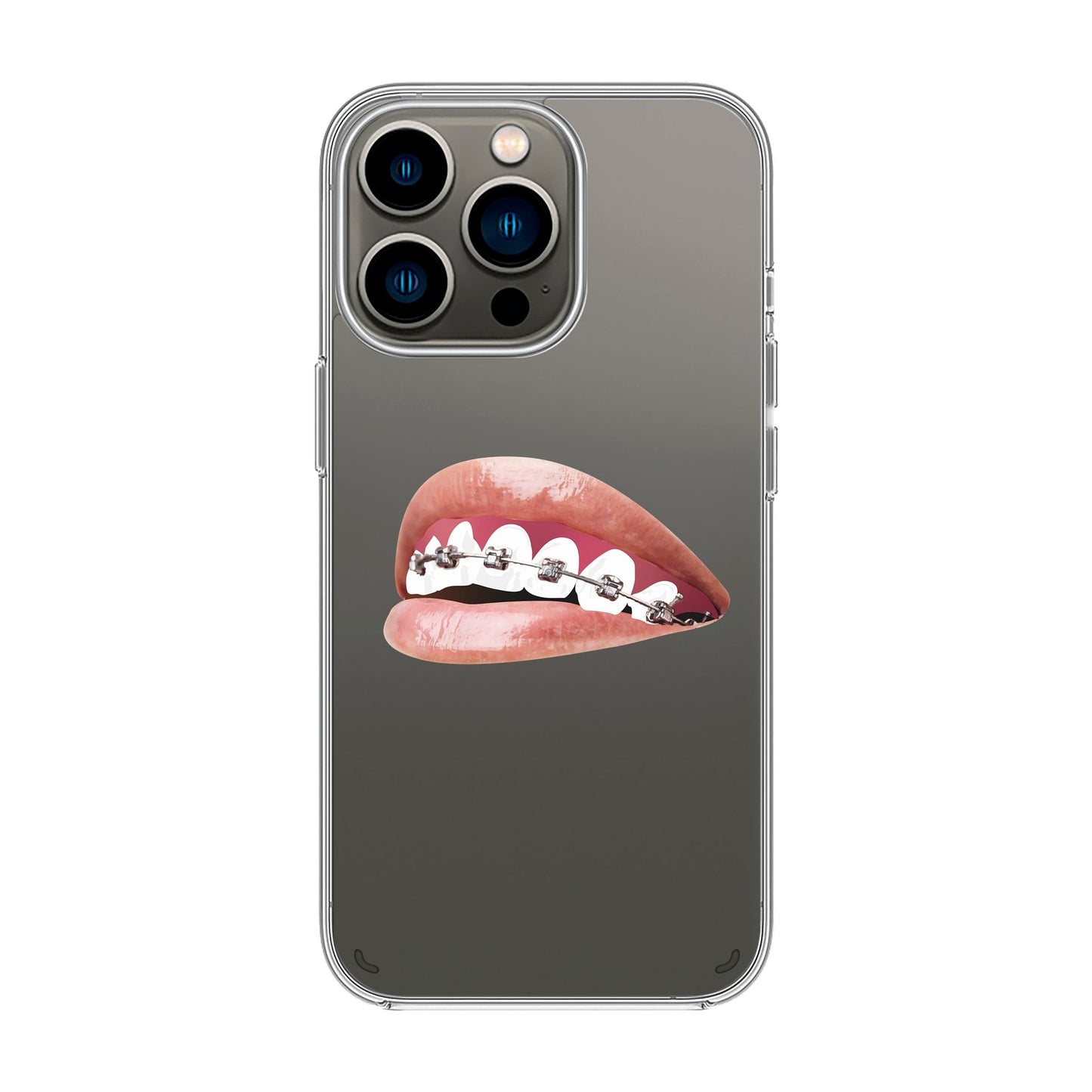 ORTHODONTIST-iPhone X / Xs Solid Kılıf