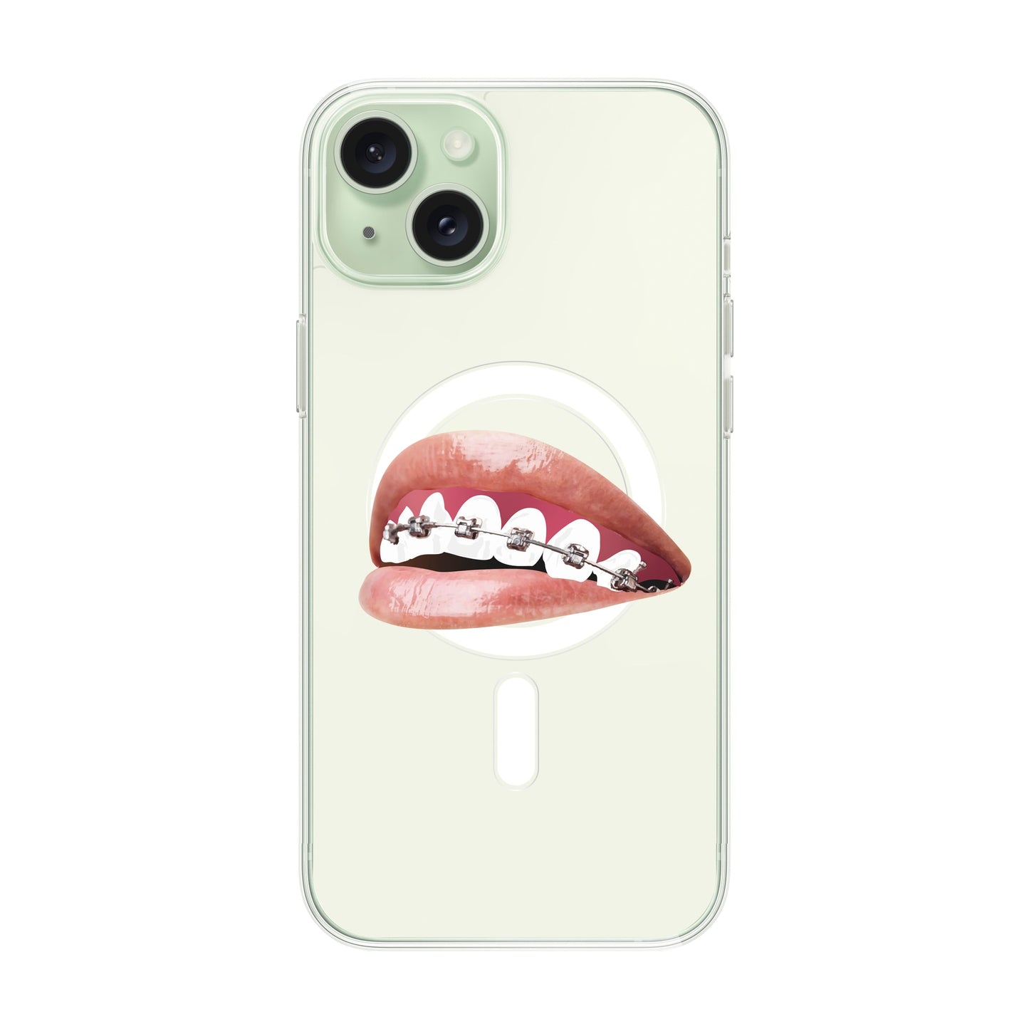 ORTHODONTIST-iPhone 15 Plus Solid Kılıf MagSafe Özellikli