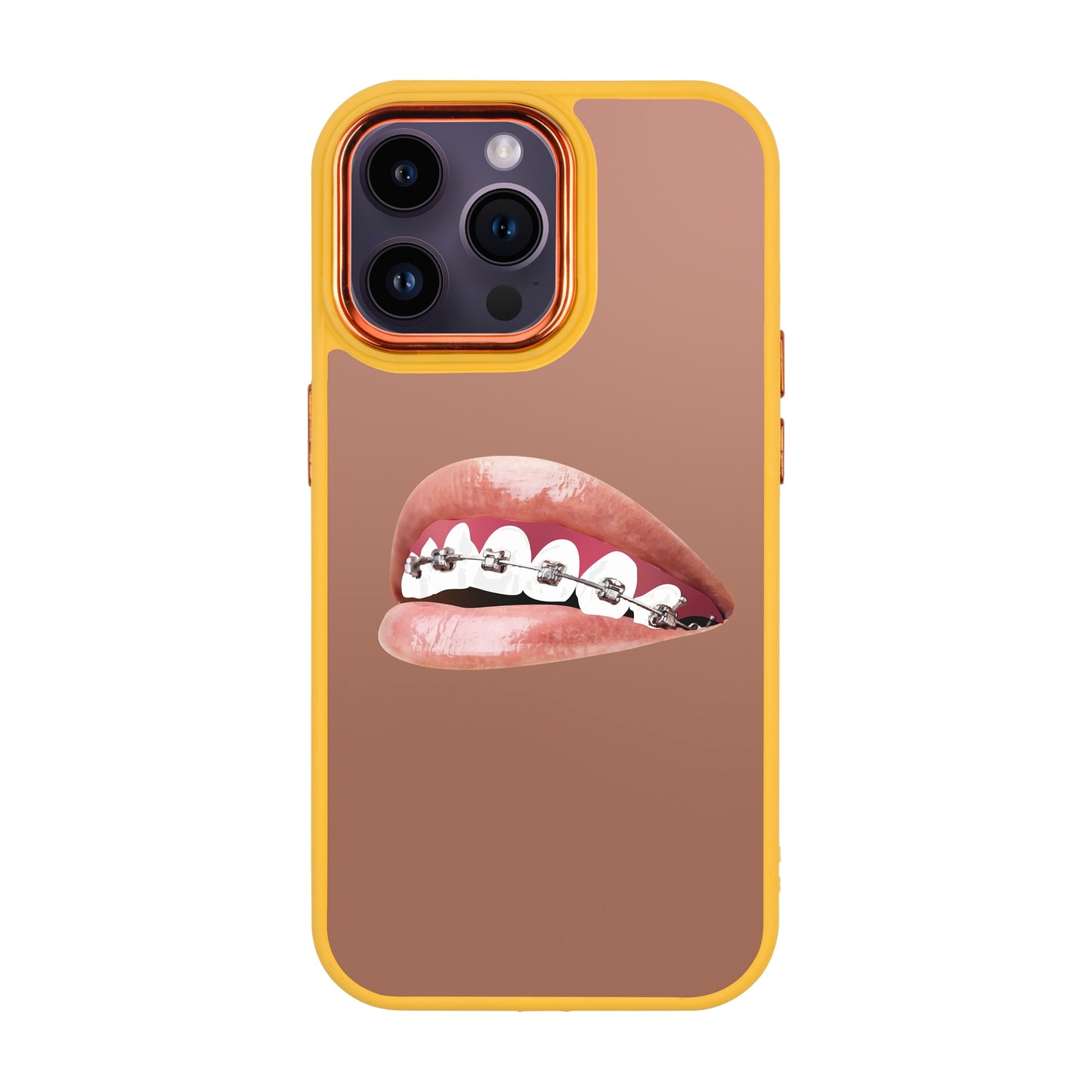ORTHODONTIST-iPhone 14 Pro Max Proof Kılıf