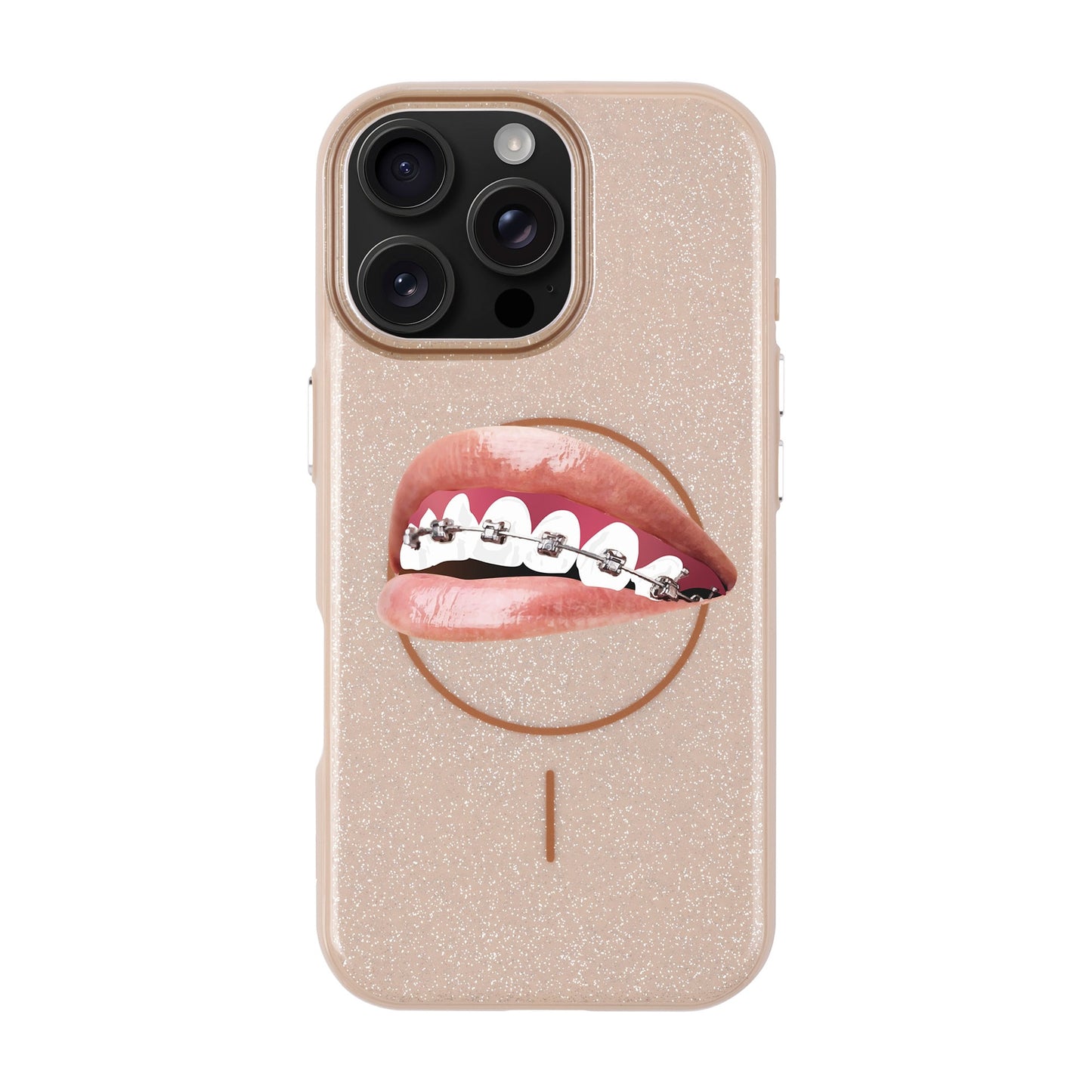 ORTHODONTIST-iPhone 16 Pro Max Radiant Kılıf MagSafe Özellikli