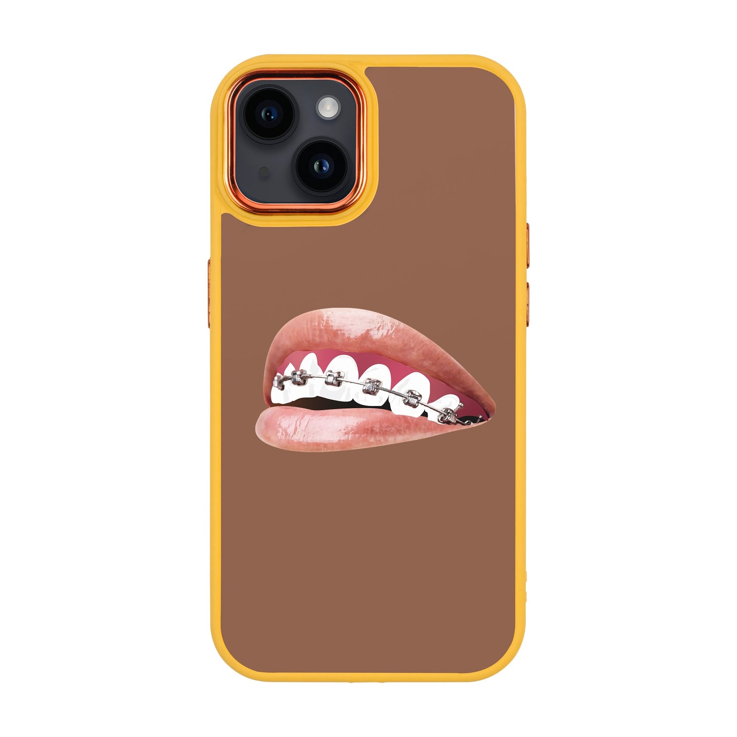 ORTHODONTIST-iPhone 14 Plus Proof Kılıf