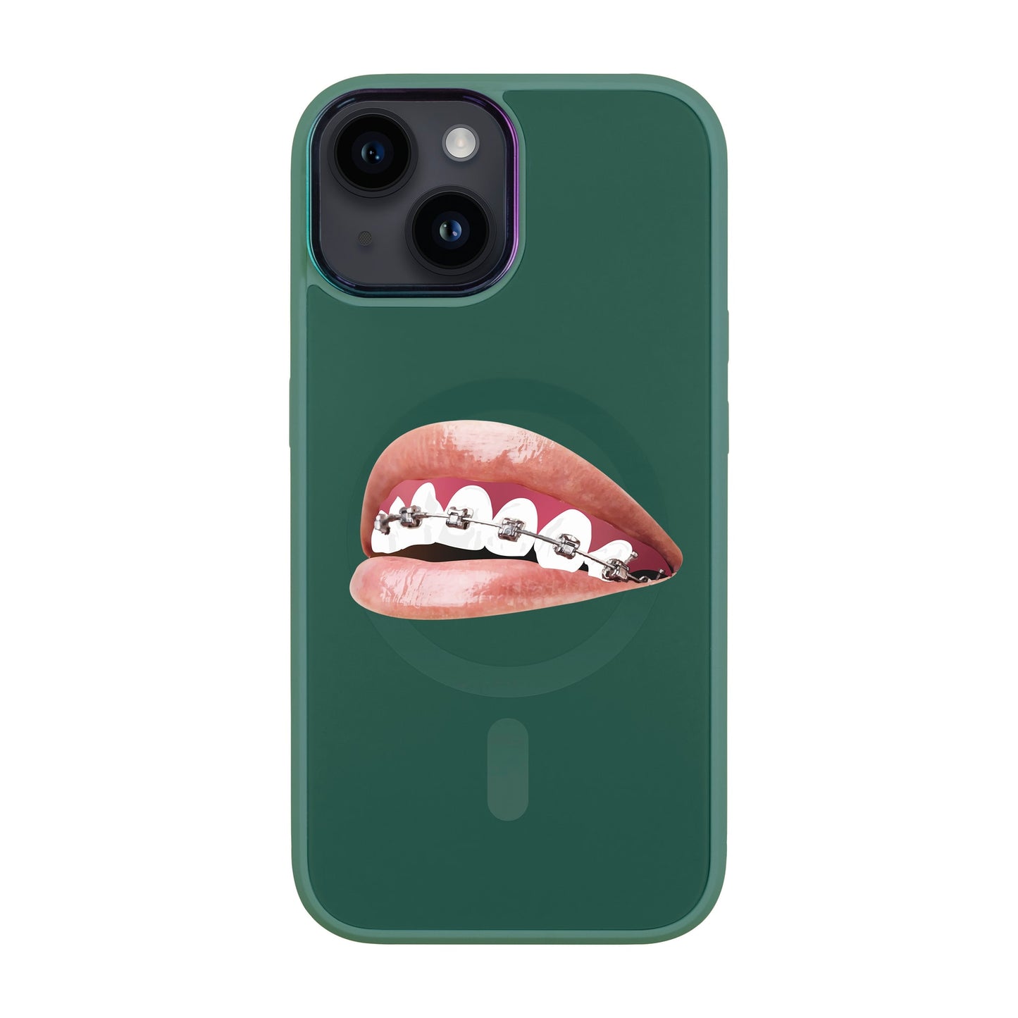 ORTHODONTİST-iPhone 12 Vigor Kılıf MagSafe Özellikli