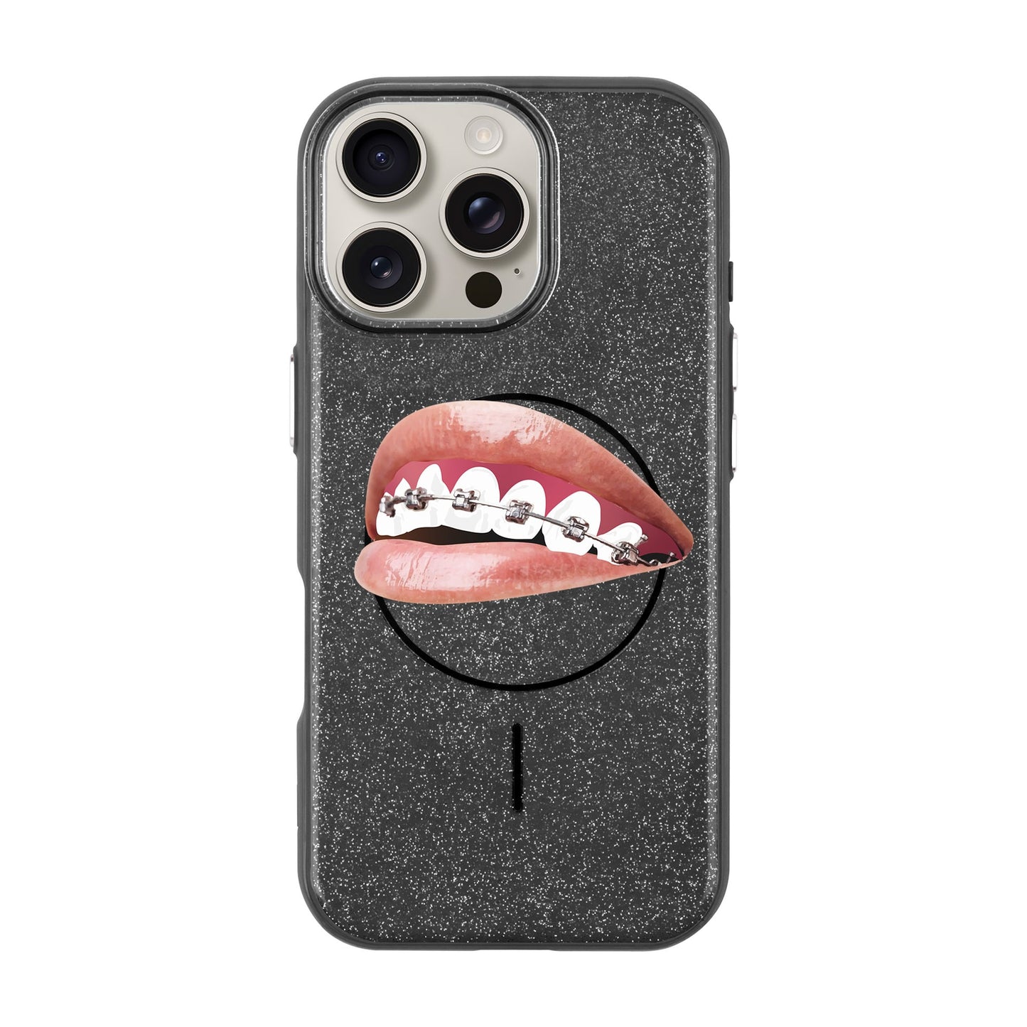 ORTHODONTIST-iPhone 16 Pro Max Radiant Kılıf MagSafe Özellikli