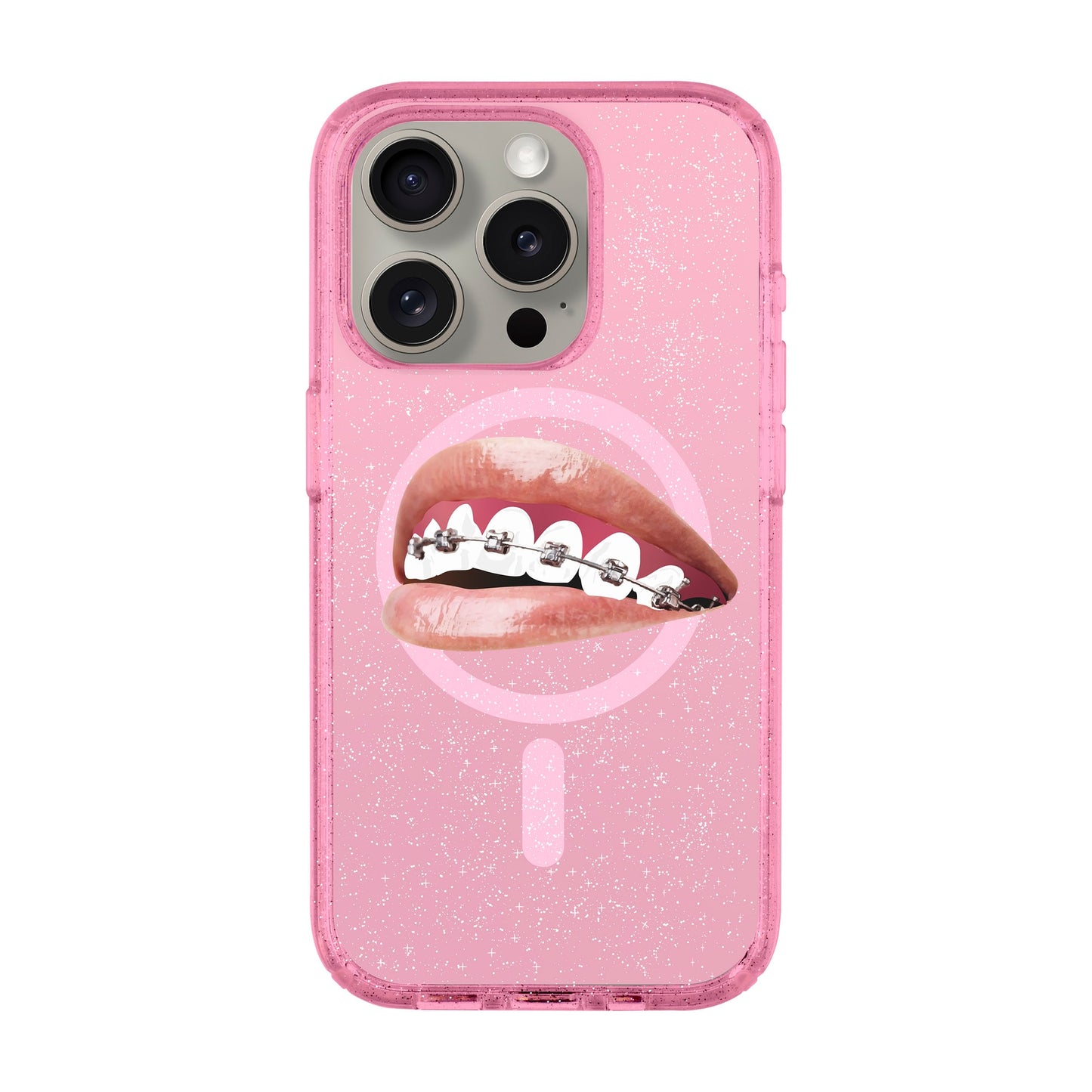 ORTHODONTIST-iPhone 15 Pro Shiny Kılıf MagSafe Özellikli