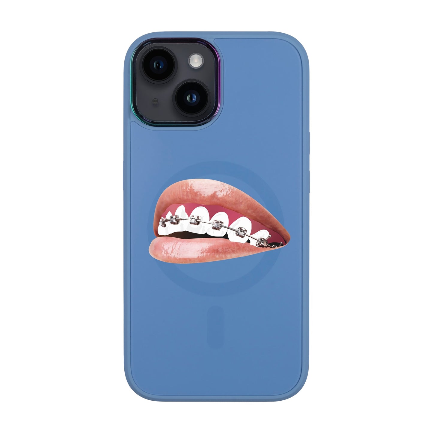 ORTHODONTİST-iPhone 12 Vigor Kılıf MagSafe Özellikli
