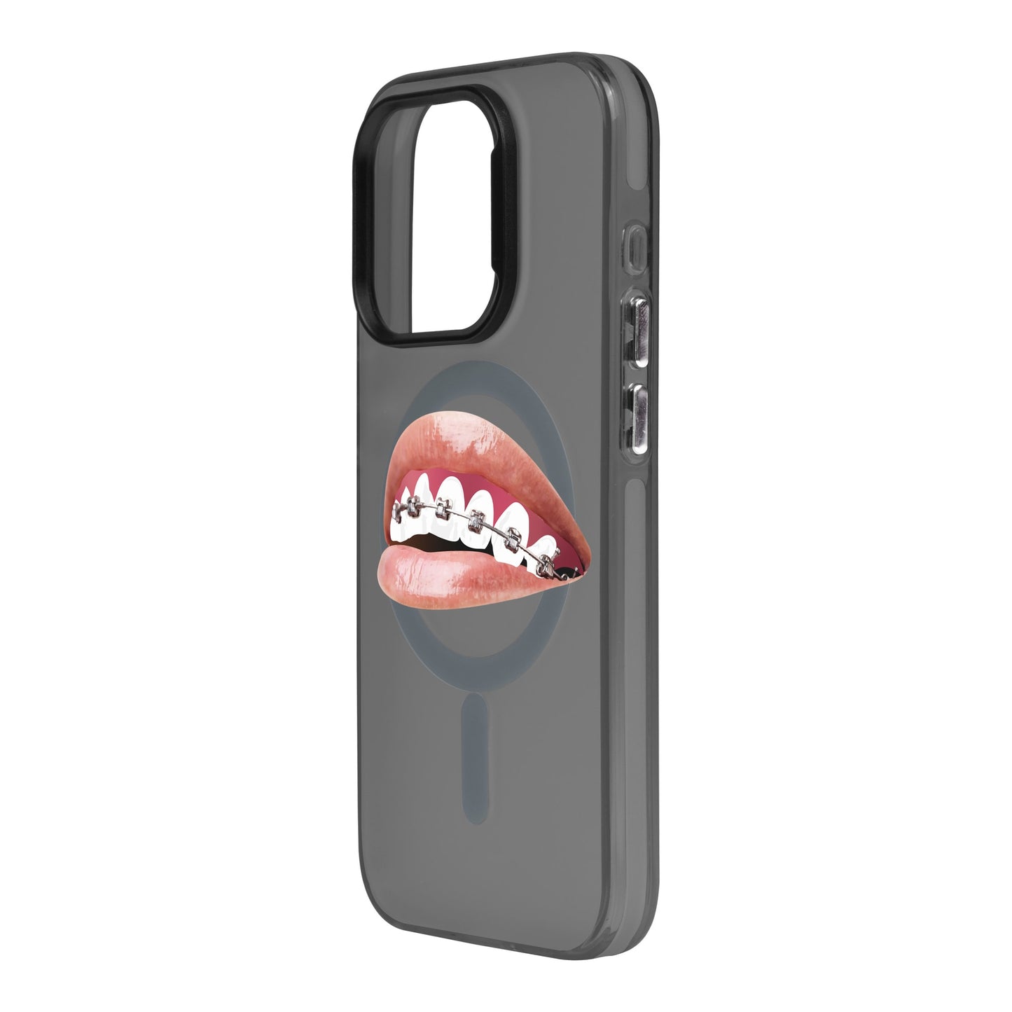 ORTHODONTIST-iPhone 15 Pro Hold Kılıf MagSafe Özellikli