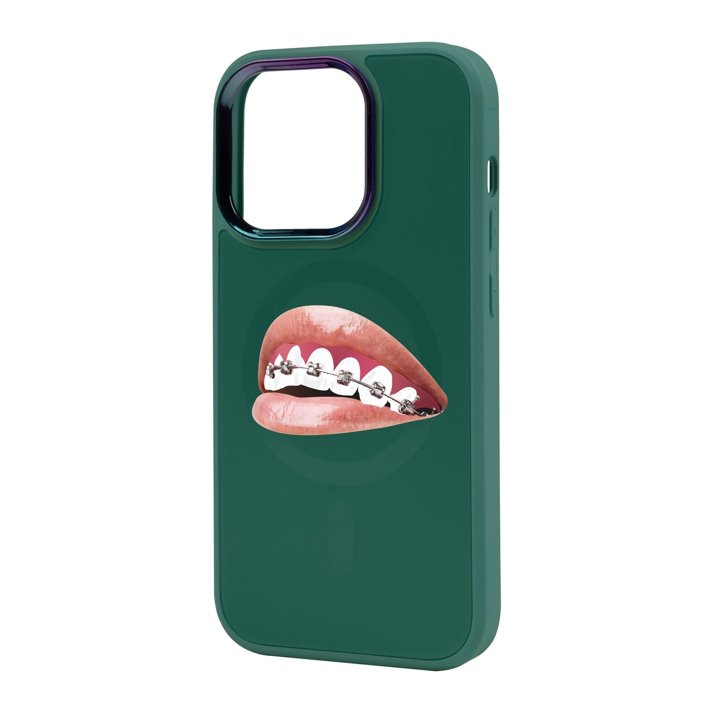 ORTHODONTİST-iPhone 14 Pro Max Vigor Kılıf MagSafe Özellikli