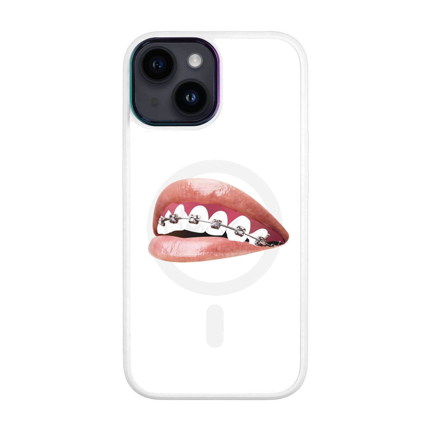 ORTHODONTİST-iPhone 12 Vigor Kılıf MagSafe Özellikli