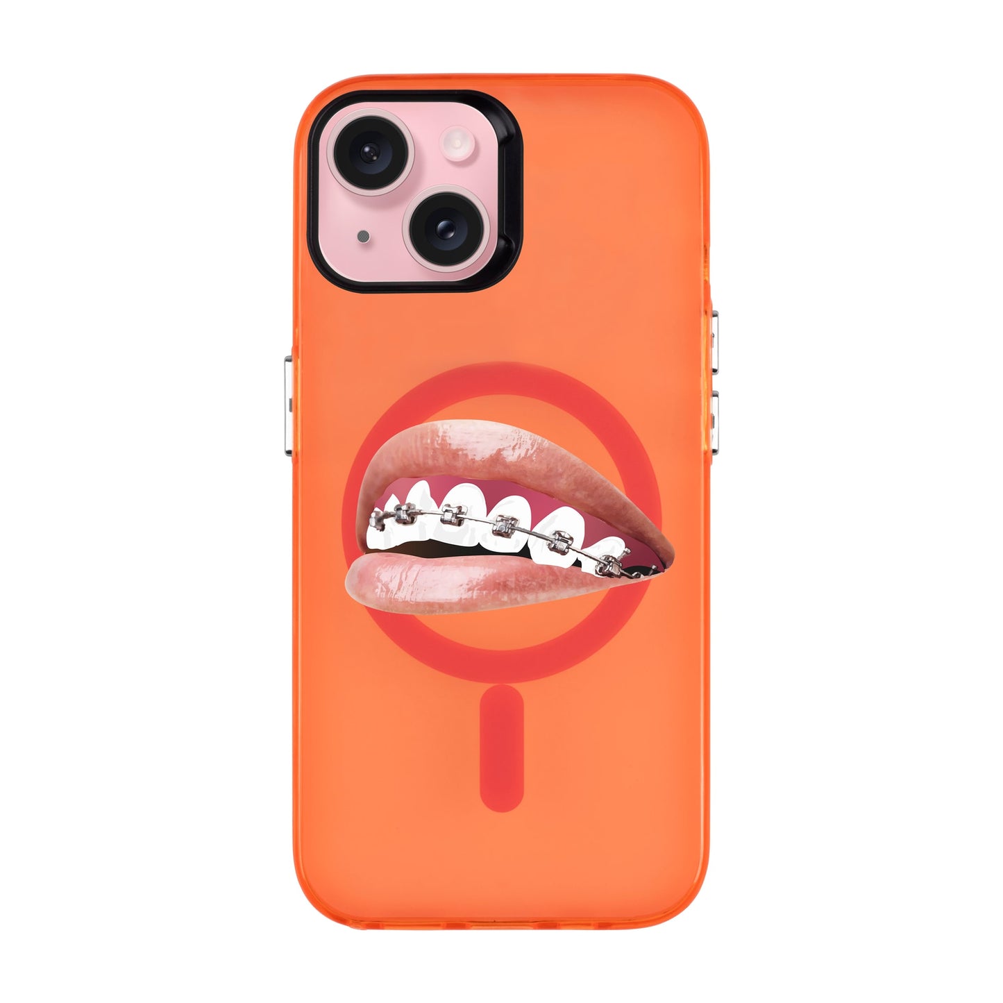 ORTHODONTIST-iPhone 15 Hold Kılıf MagSafe Özellikli