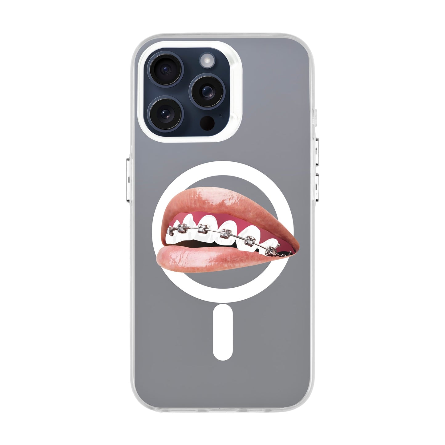 ORTHODONTIST-iPhone 15 Pro Max Hold Kılıf MagSafe Özellikli