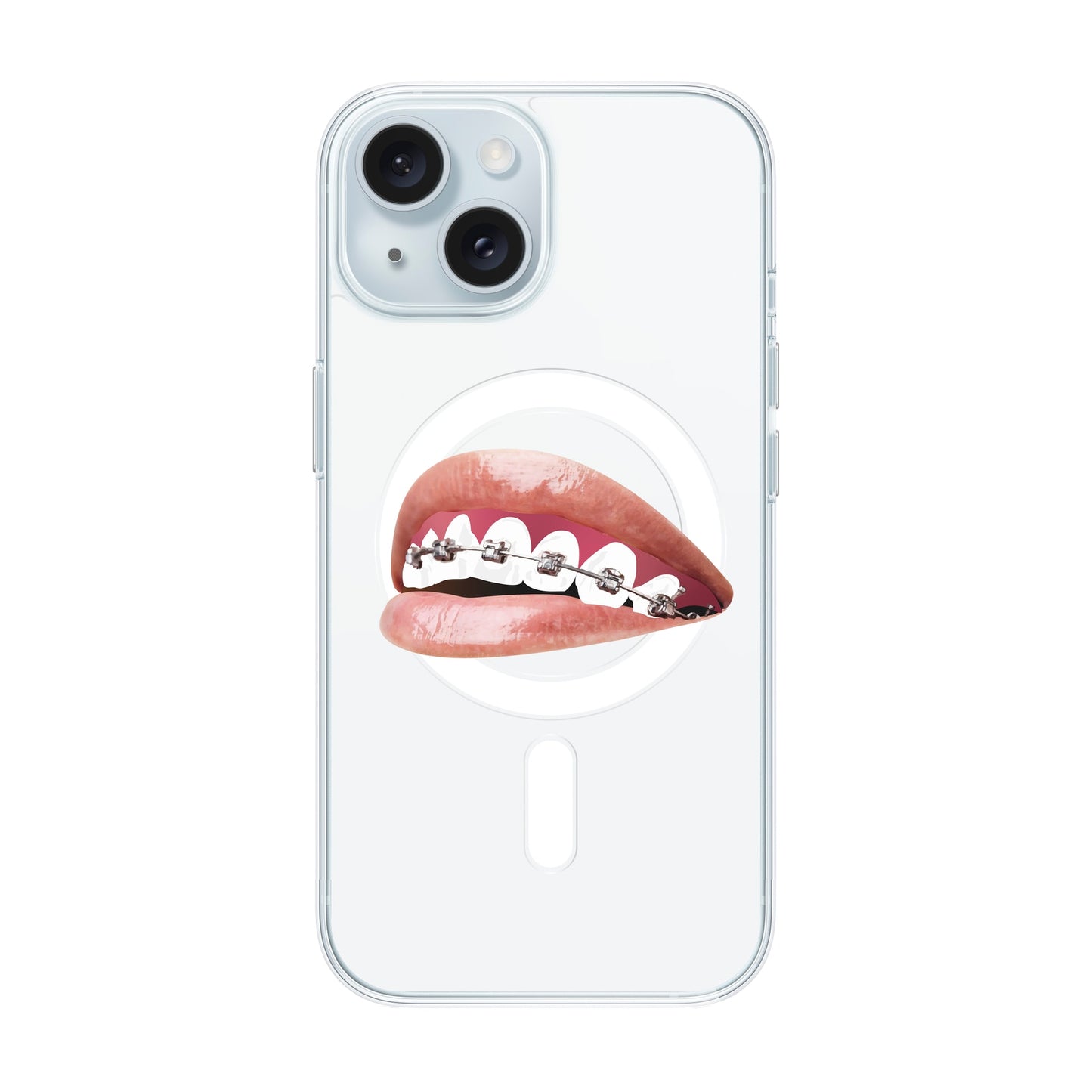 ORTHODONTIST-iPhone 15 Solid Kılıf MagSafe Özellikli