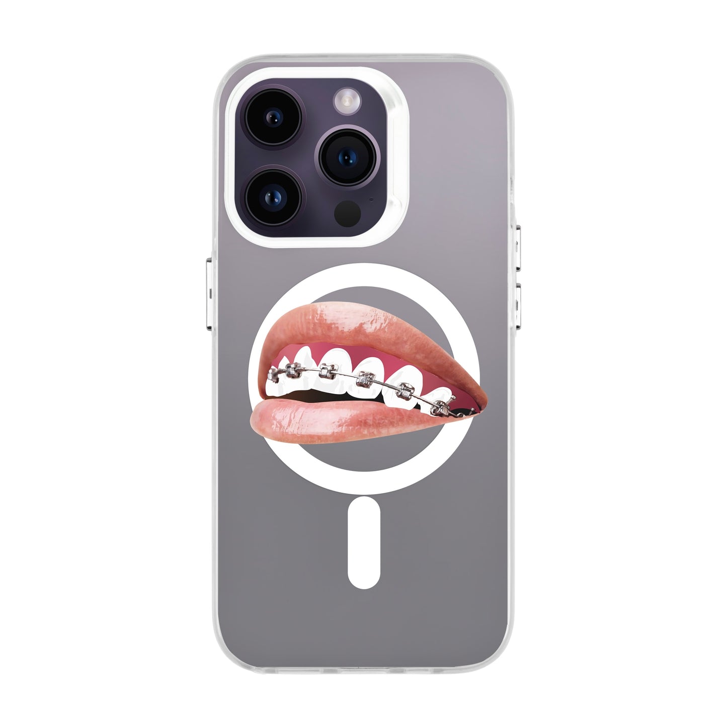ORTHODONTIST-iPhone 14 Pro Hold Kılıf MagSafe Özellikli