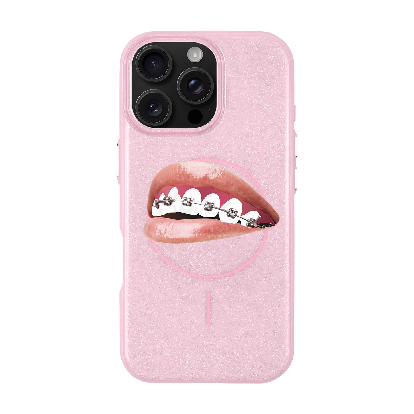 ORTHODONTIST-iPhone 16 Pro Max Radiant Kılıf MagSafe Özellikli