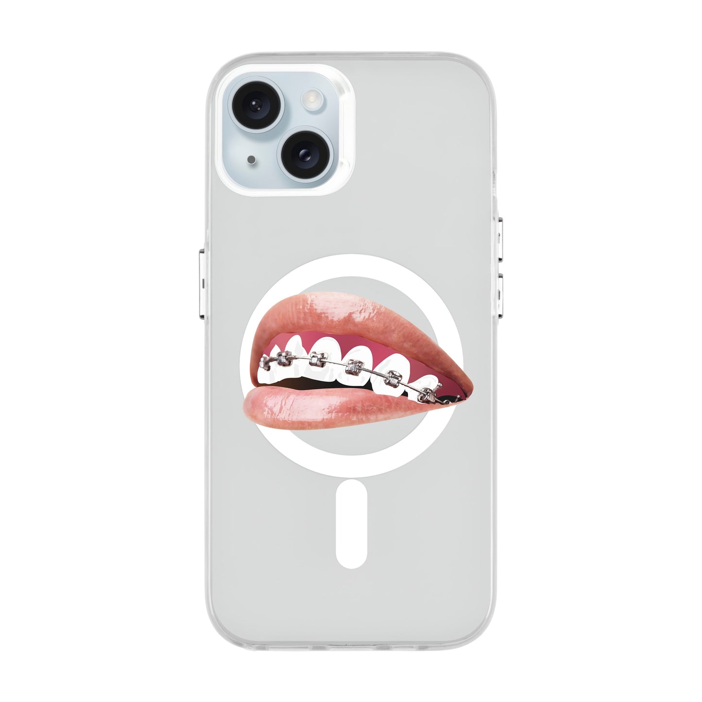 ORTHODONTIST-iPhone 15 Plus Hold Kılıf MagSafe Özellikli