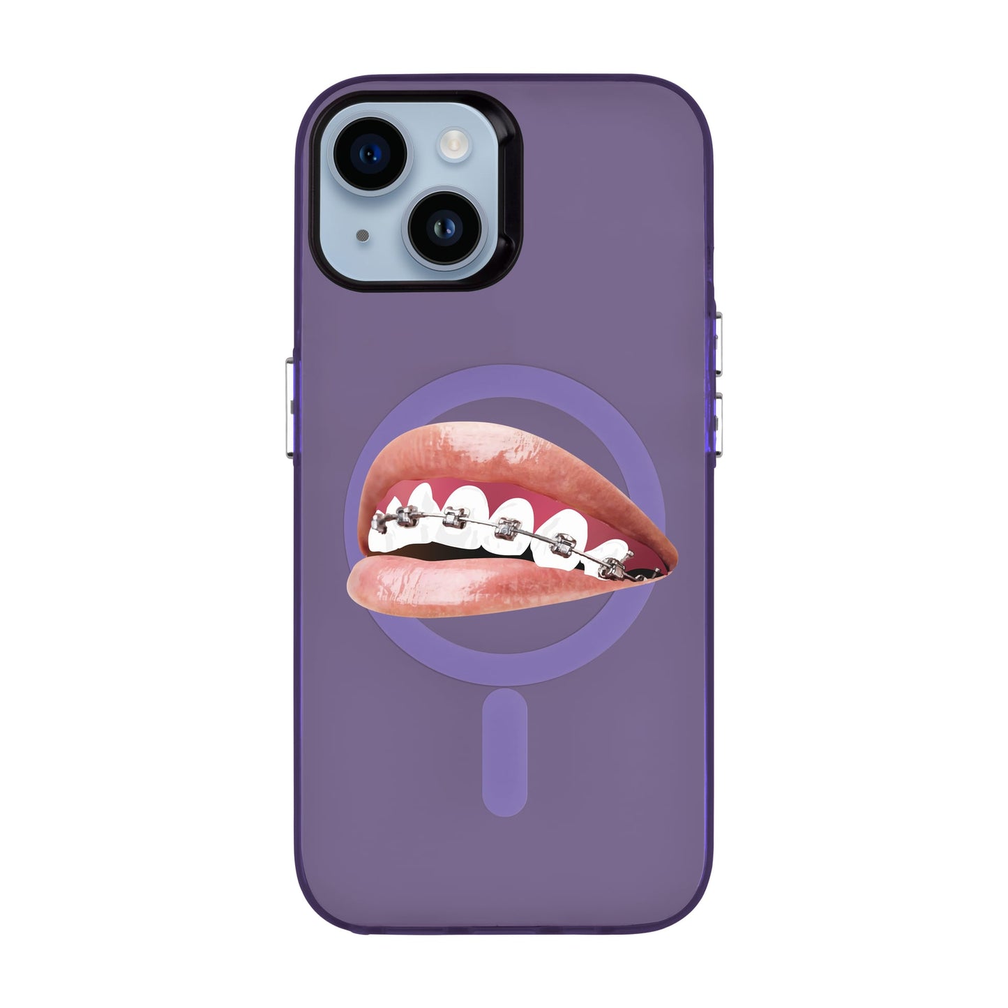 ORTHODONTIST-iPhone 14 Hold Kılıf MagSafe Özellikli
