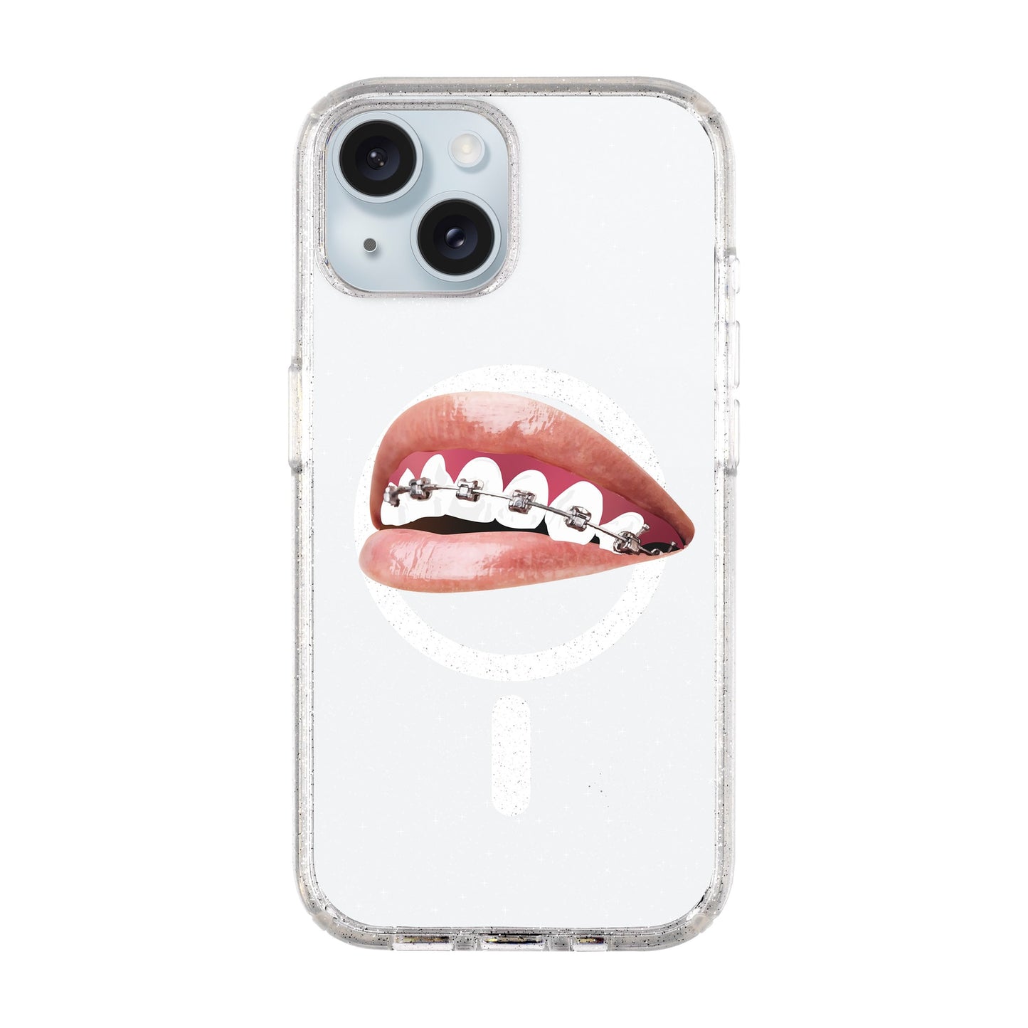 ORTHODONTIST-iPhone 15 Plus Shiny Kılıf MagSafe Özellikli