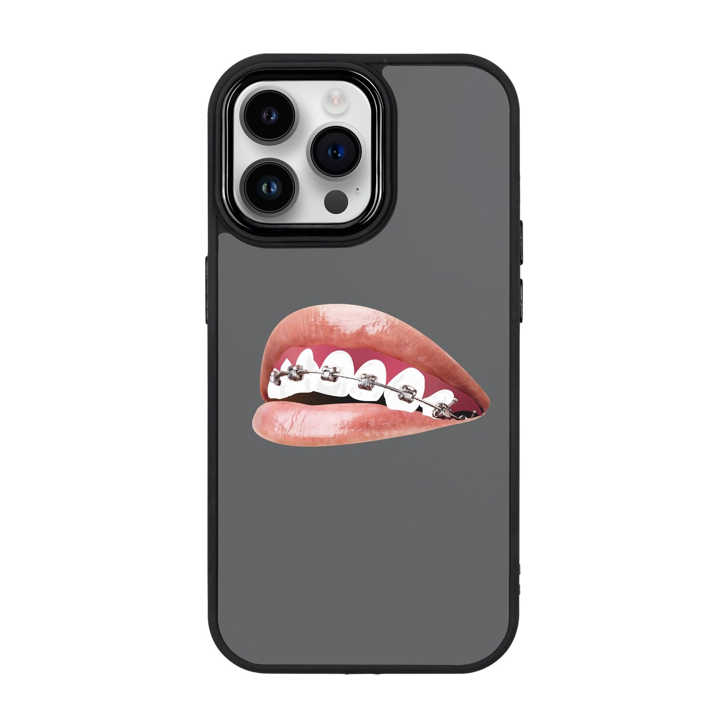 ORTHODONTIST-iPhone 14 Pro Max Proof Kılıf
