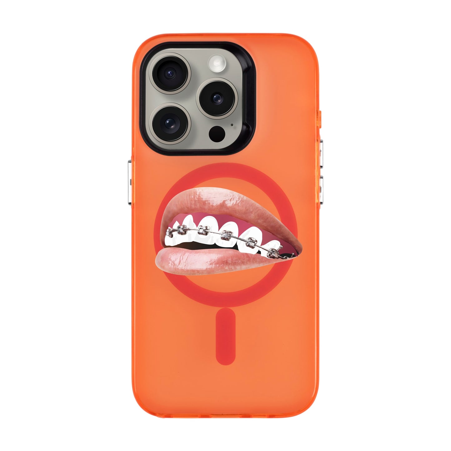 ORTHODONTIST-iPhone 15 Pro Hold Kılıf MagSafe Özellikli