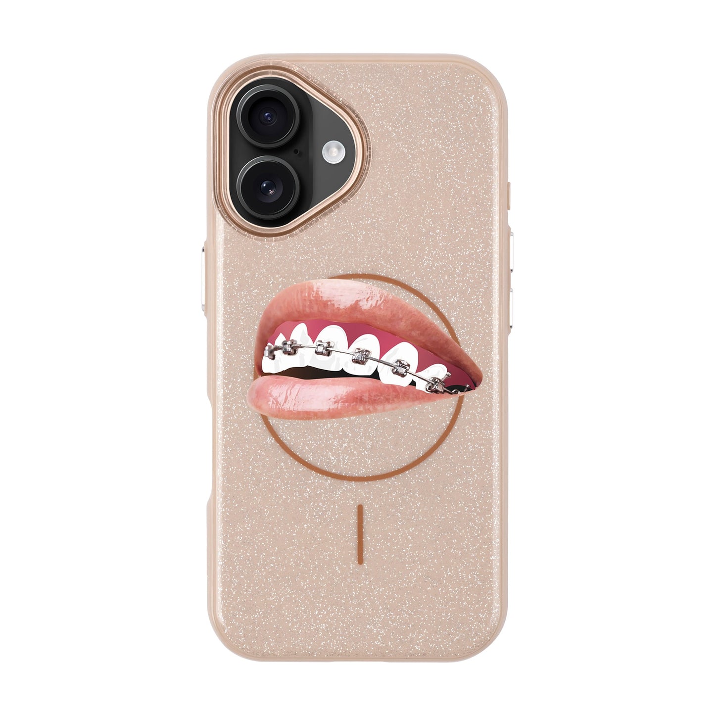 ORTHODONTIST-iPhone 16 Radiant Kılıf MagSafe Özellikli