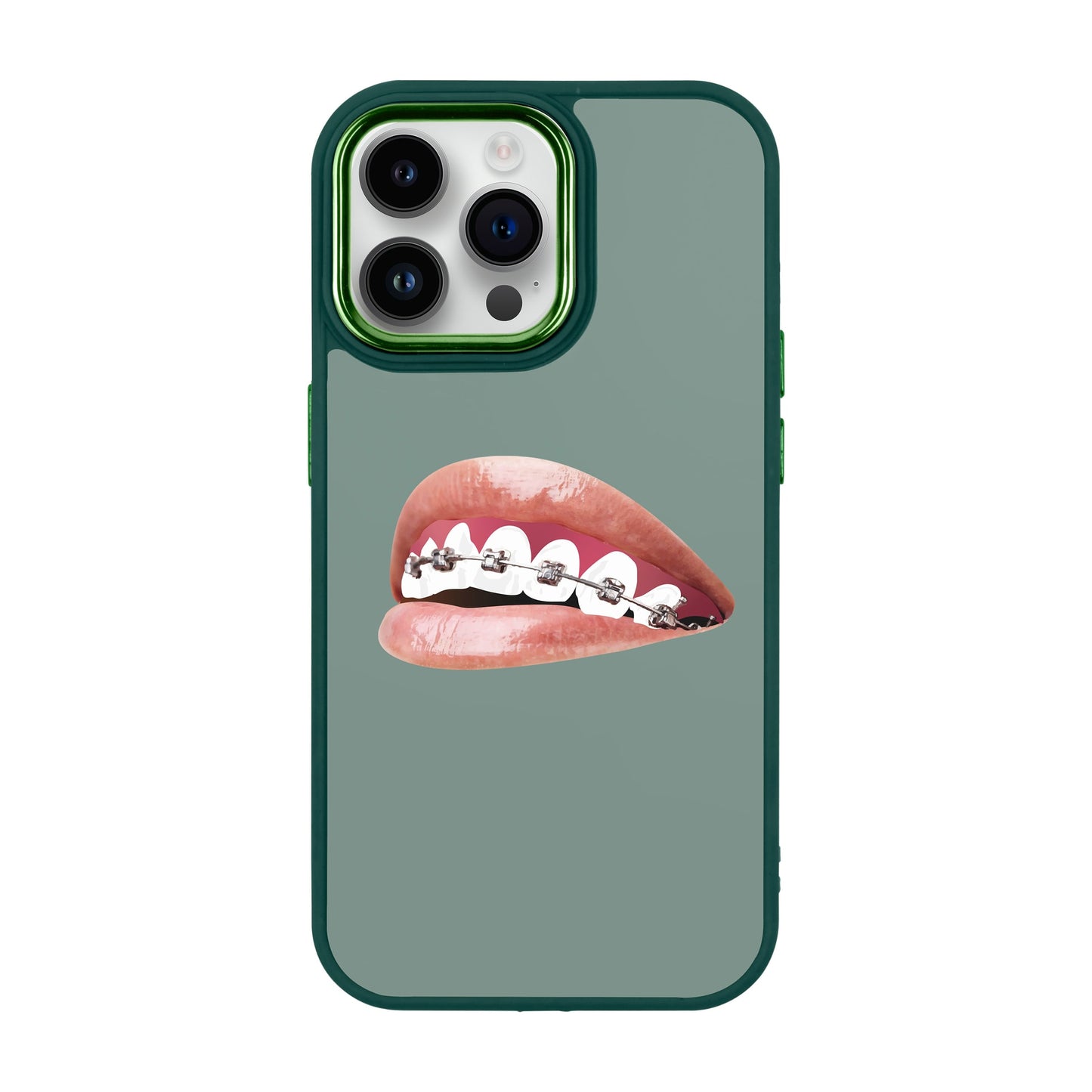 ORTHODONTIST-iPhone 14 Pro Max Proof Kılıf