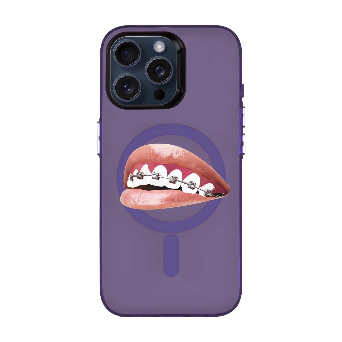 ORTHODONTIST-iPhone 15 Pro Max Hold Kılıf MagSafe Özellikli